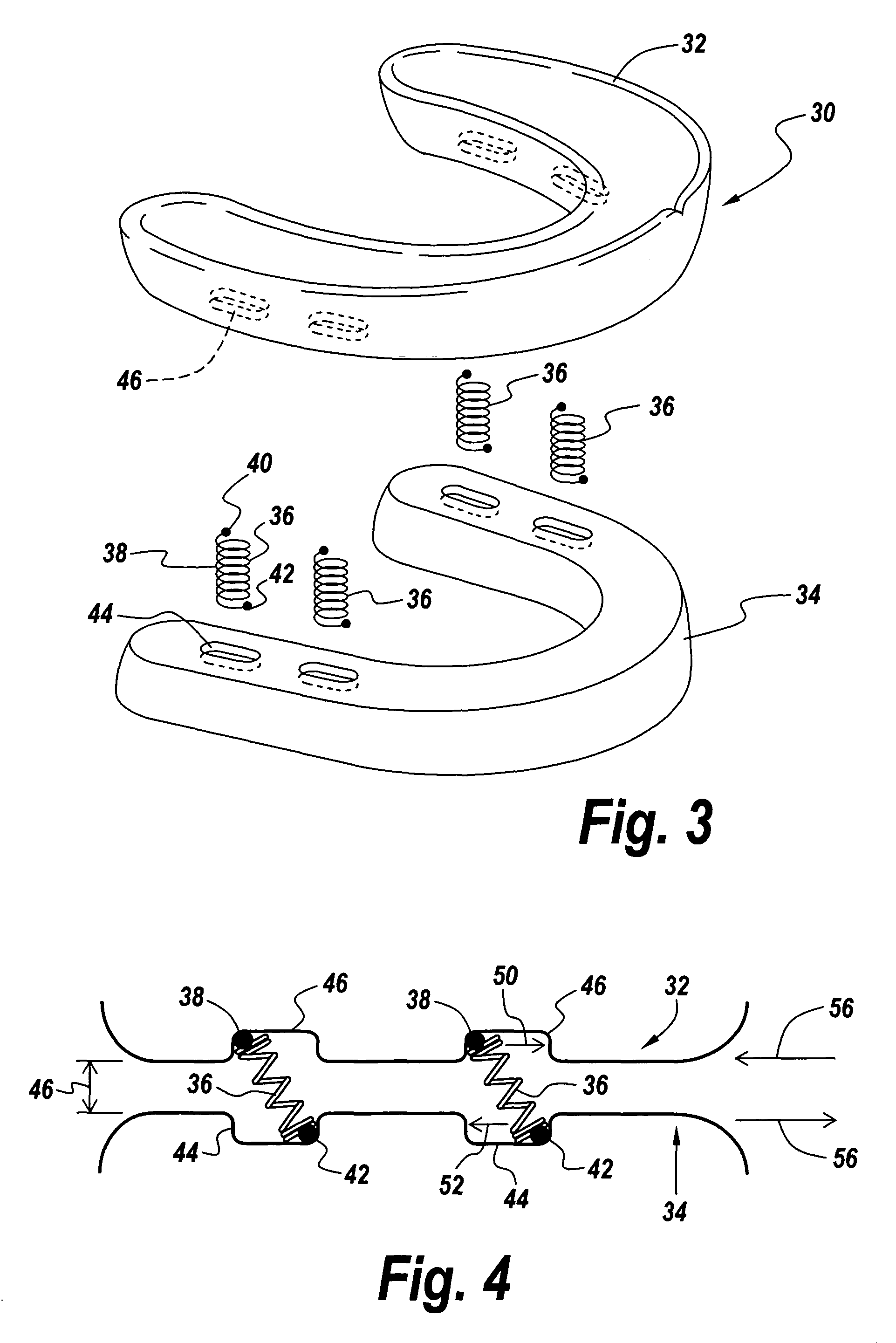 Method and apparatus for protecting teeth, preventing the effects of bruxism and protecting oral structures from sports injuries