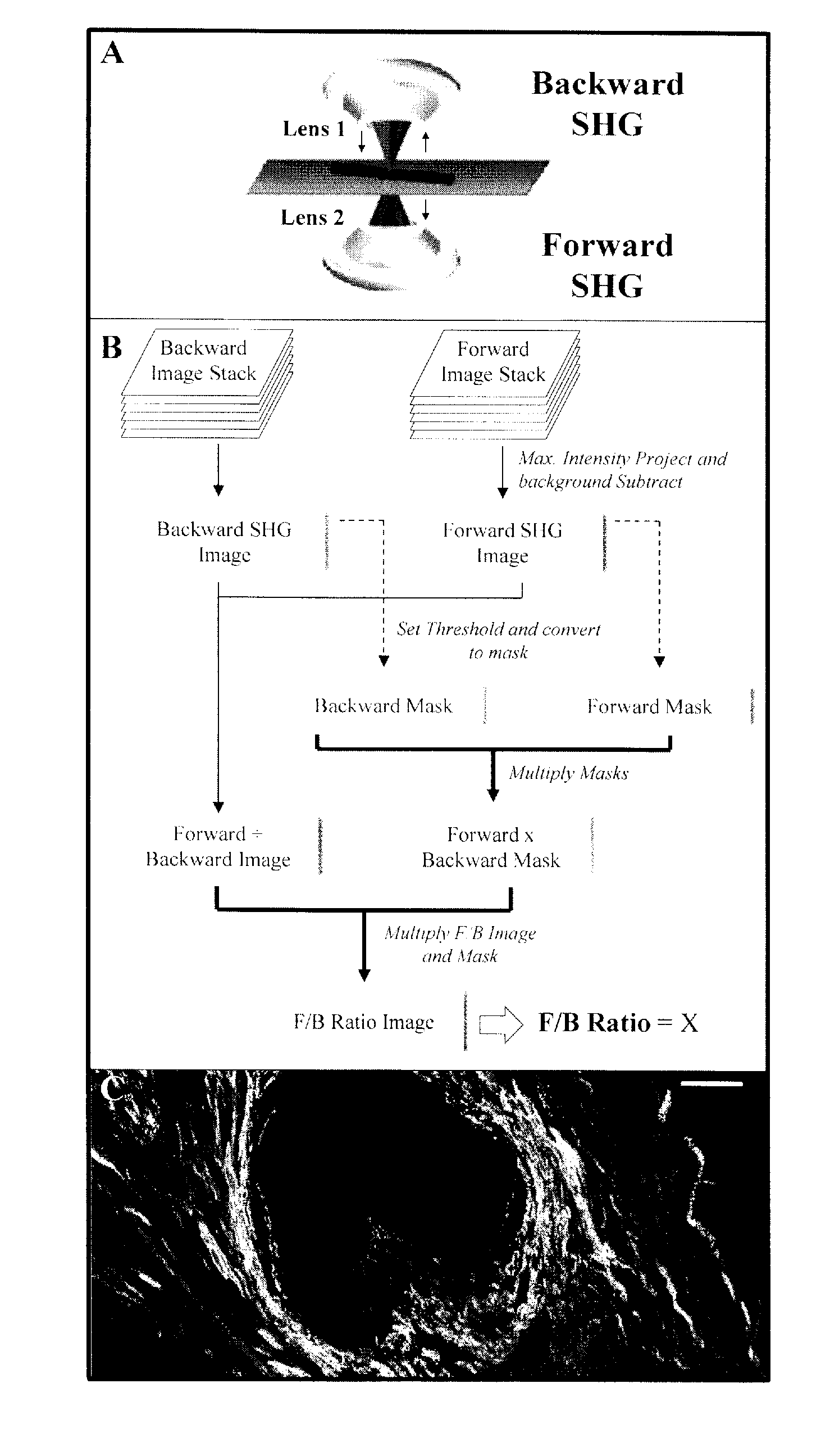 Method And Apparatus To Diagnose The Metastatic Or Progressive Potential Of Cancer, Fibrosis And Other Diseases