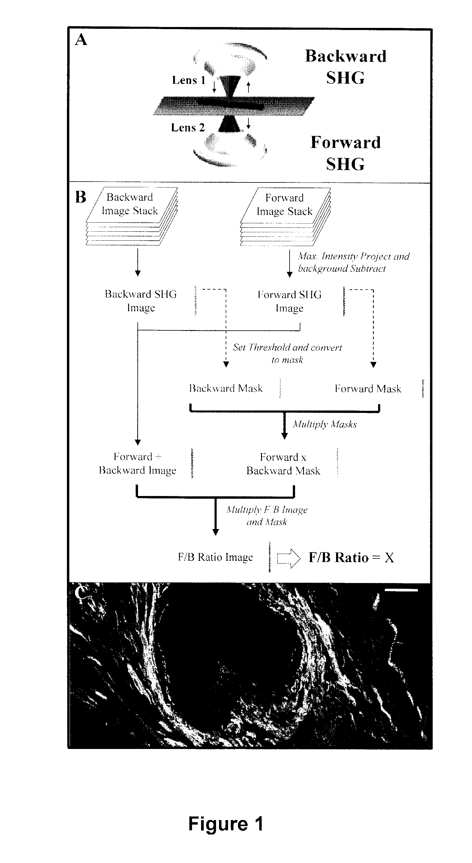 Method And Apparatus To Diagnose The Metastatic Or Progressive Potential Of Cancer, Fibrosis And Other Diseases