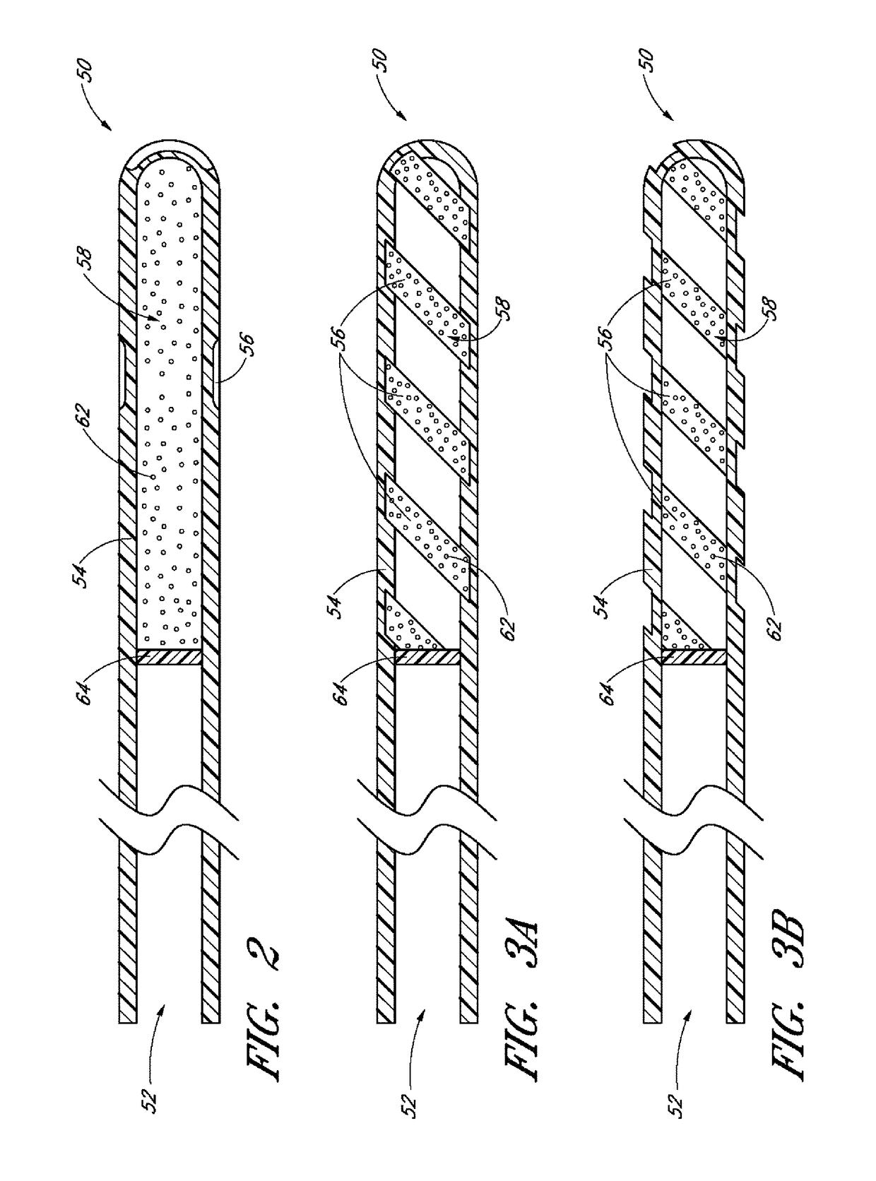 Drug delivery implants with bi-directional delivery capacity