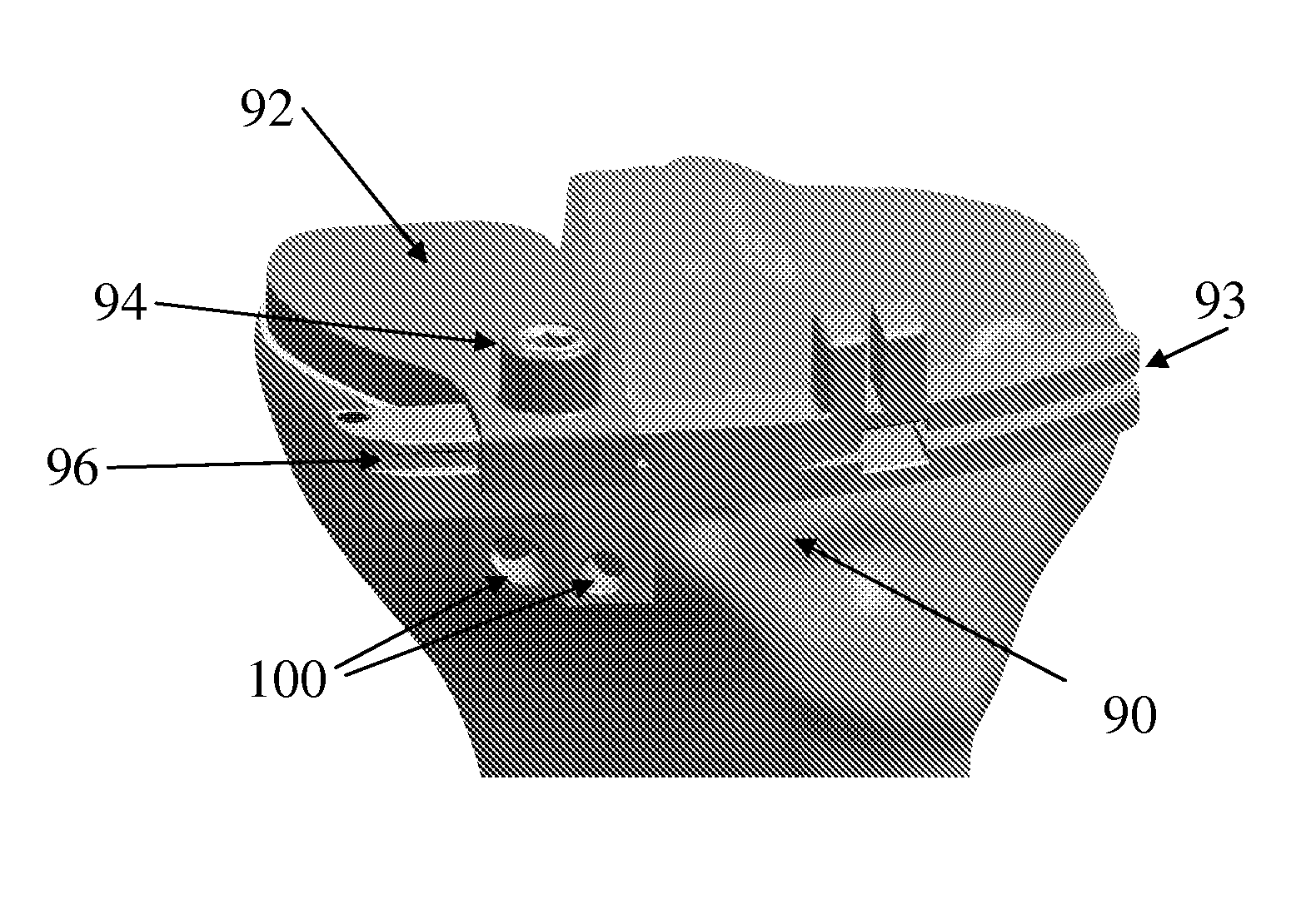 Systems, methods and devices for tibial resection