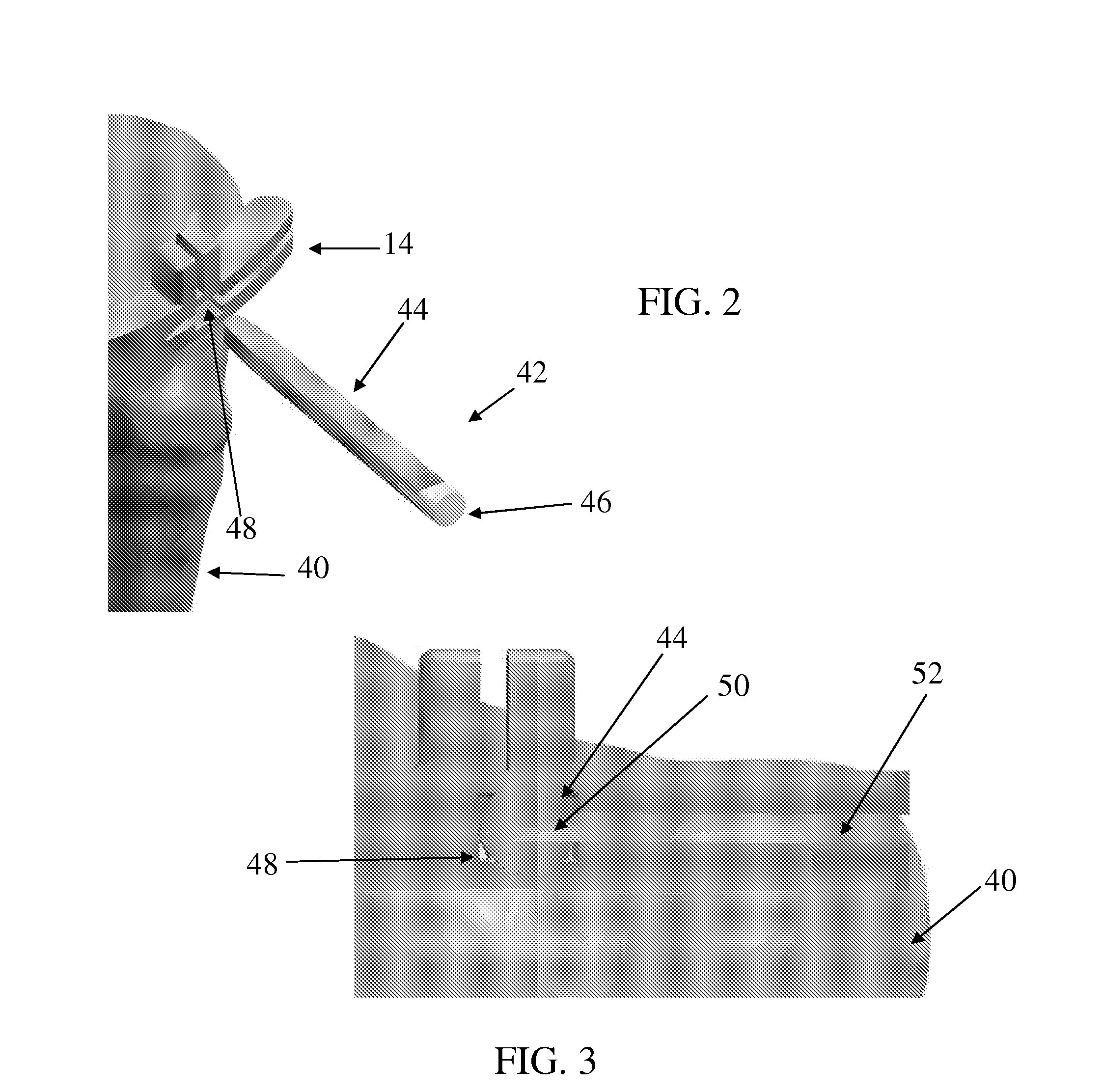 Systems, methods and devices for tibial resection