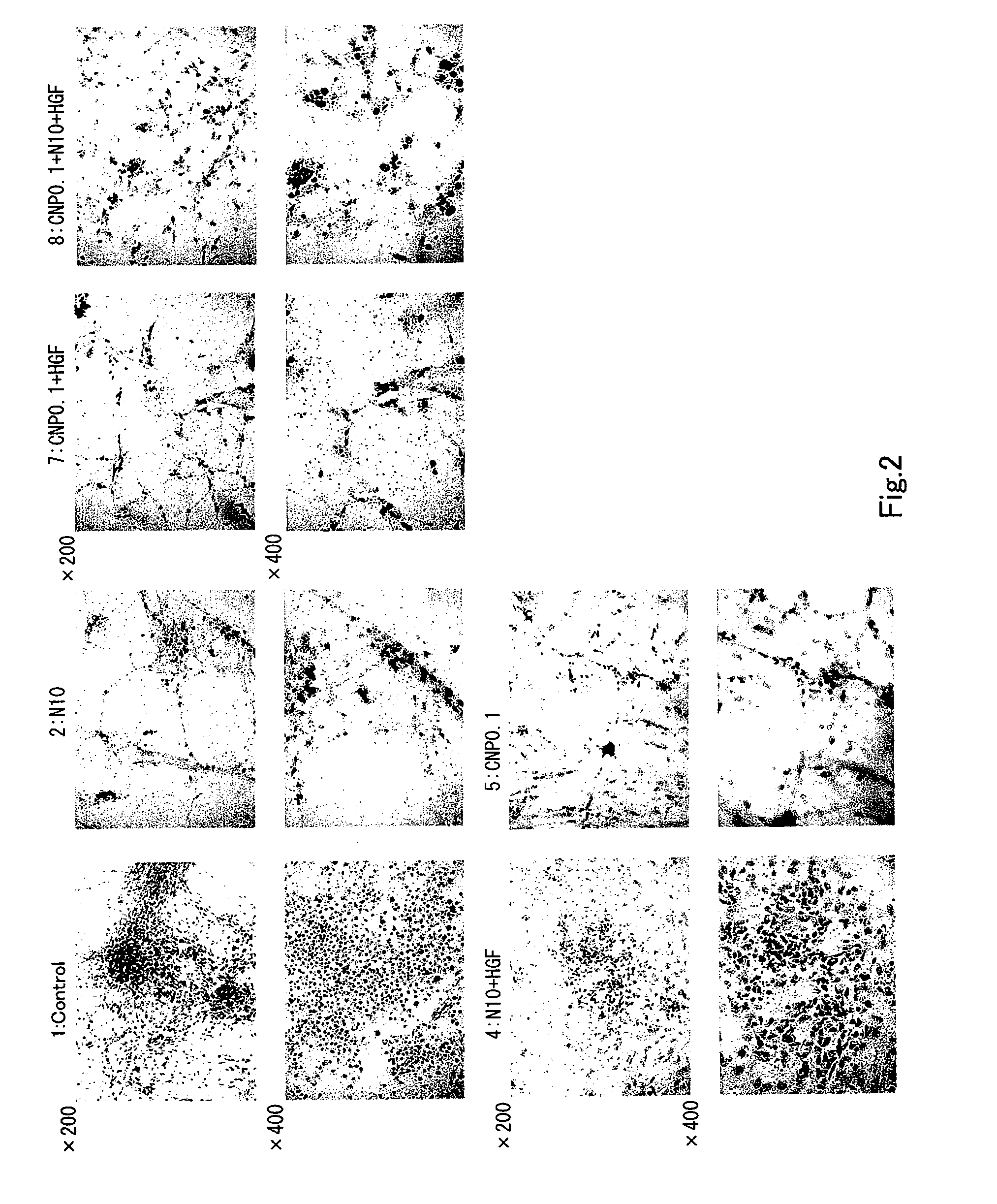 Use of vinca alkaloids and salts thereof