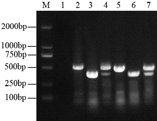 RT-PCR primers and kit for detecting high-pathopoiesia porcine reproductive andrespiratory syndrome and classic porcine reproductive andrespiratory syndrome