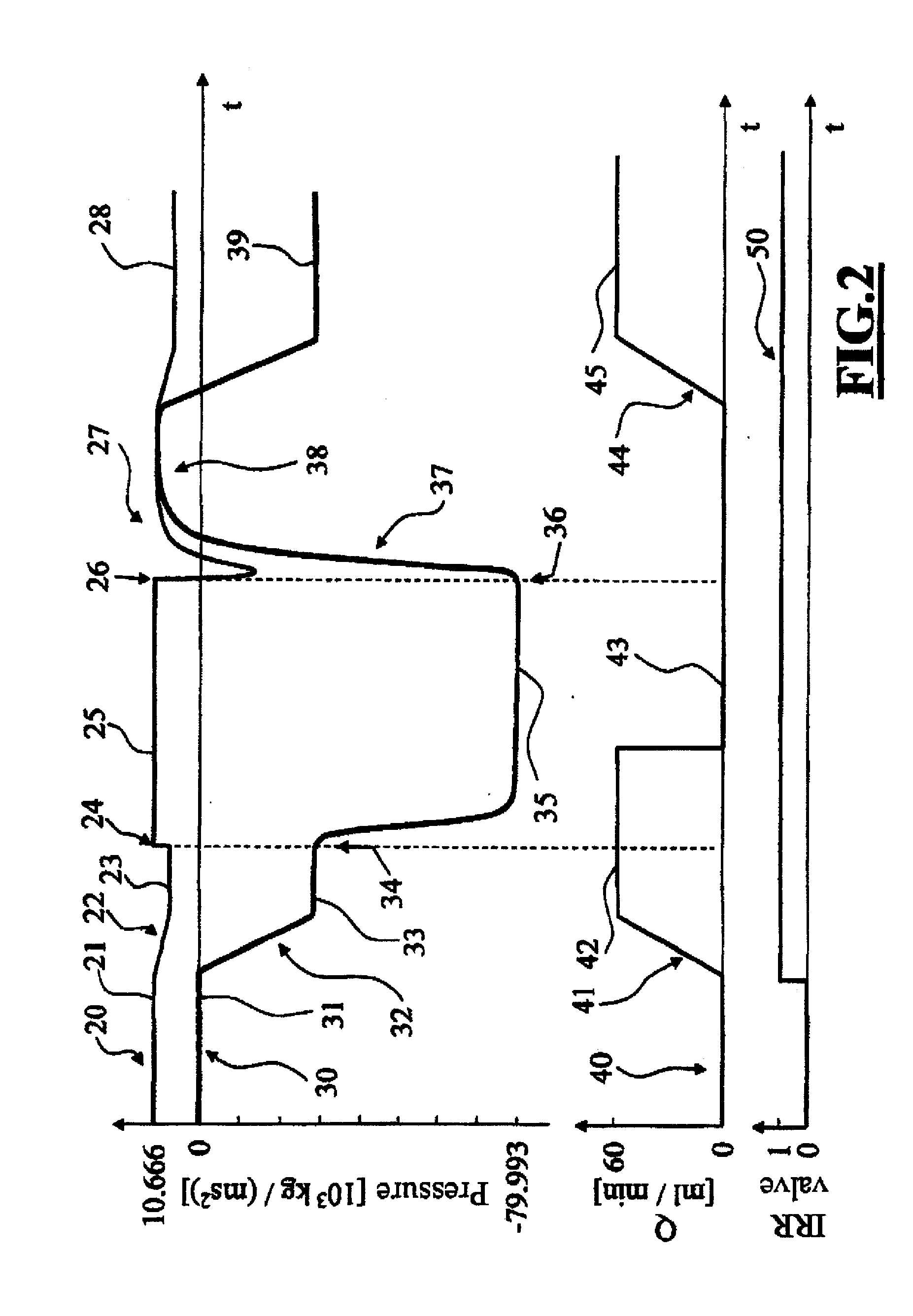 Ophthalmosurgical Measuring Device