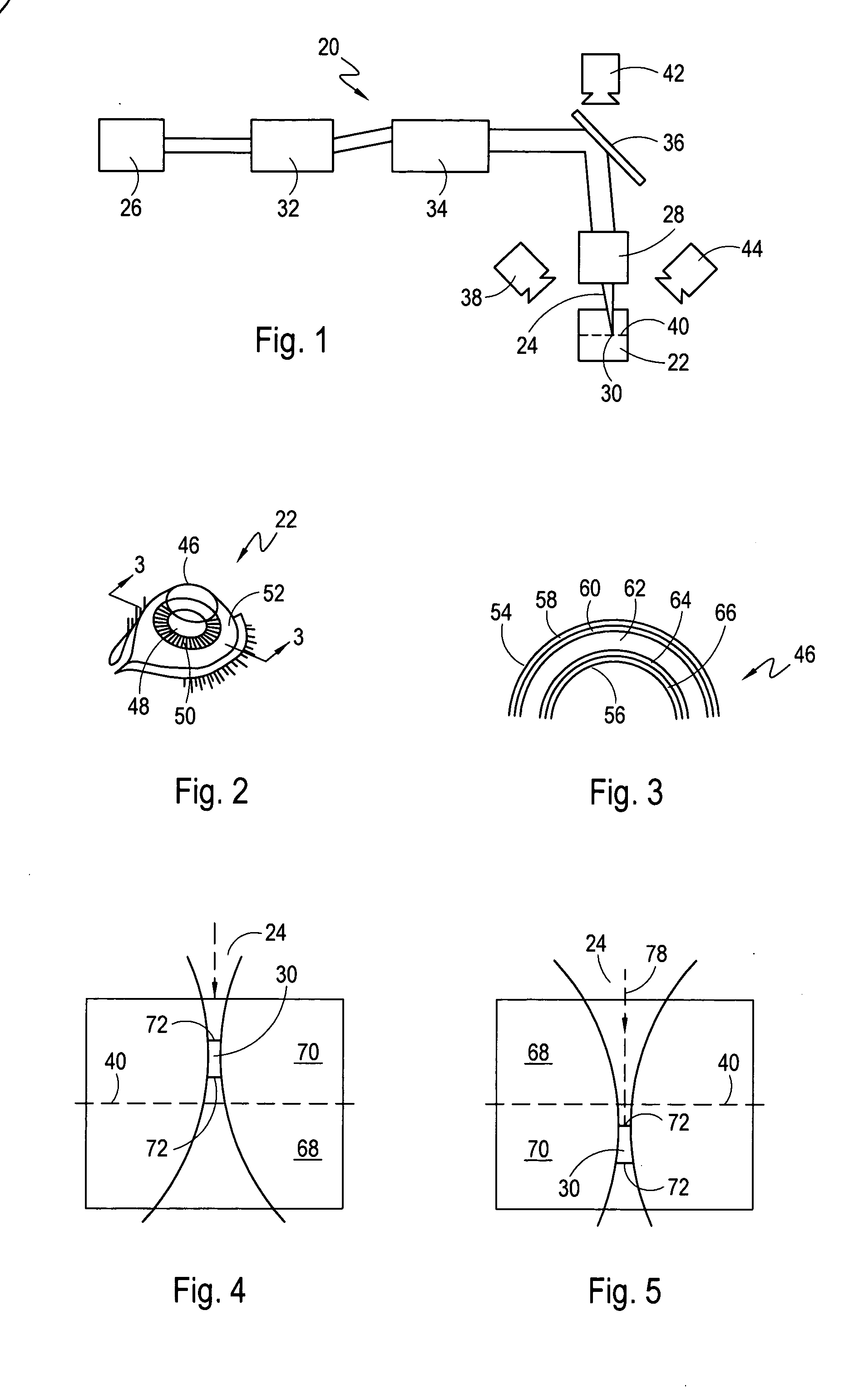 Devices and methods for separating layers of materials having different ablation thresholds