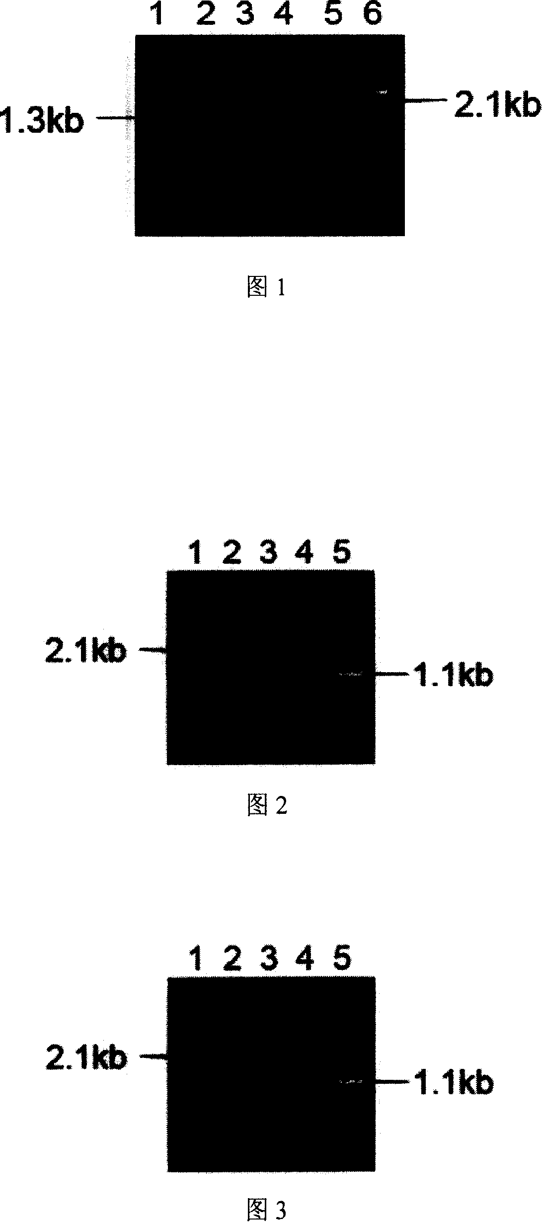 Shikimic acid prepared bacterial strain and constructing method