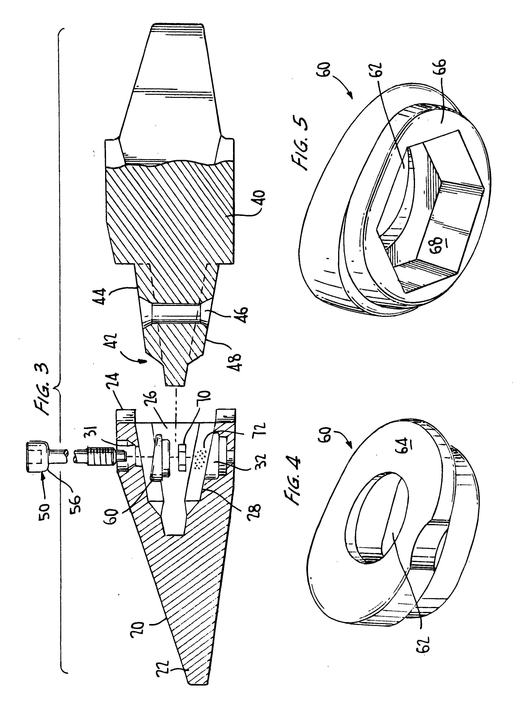 Excavation retention assembly