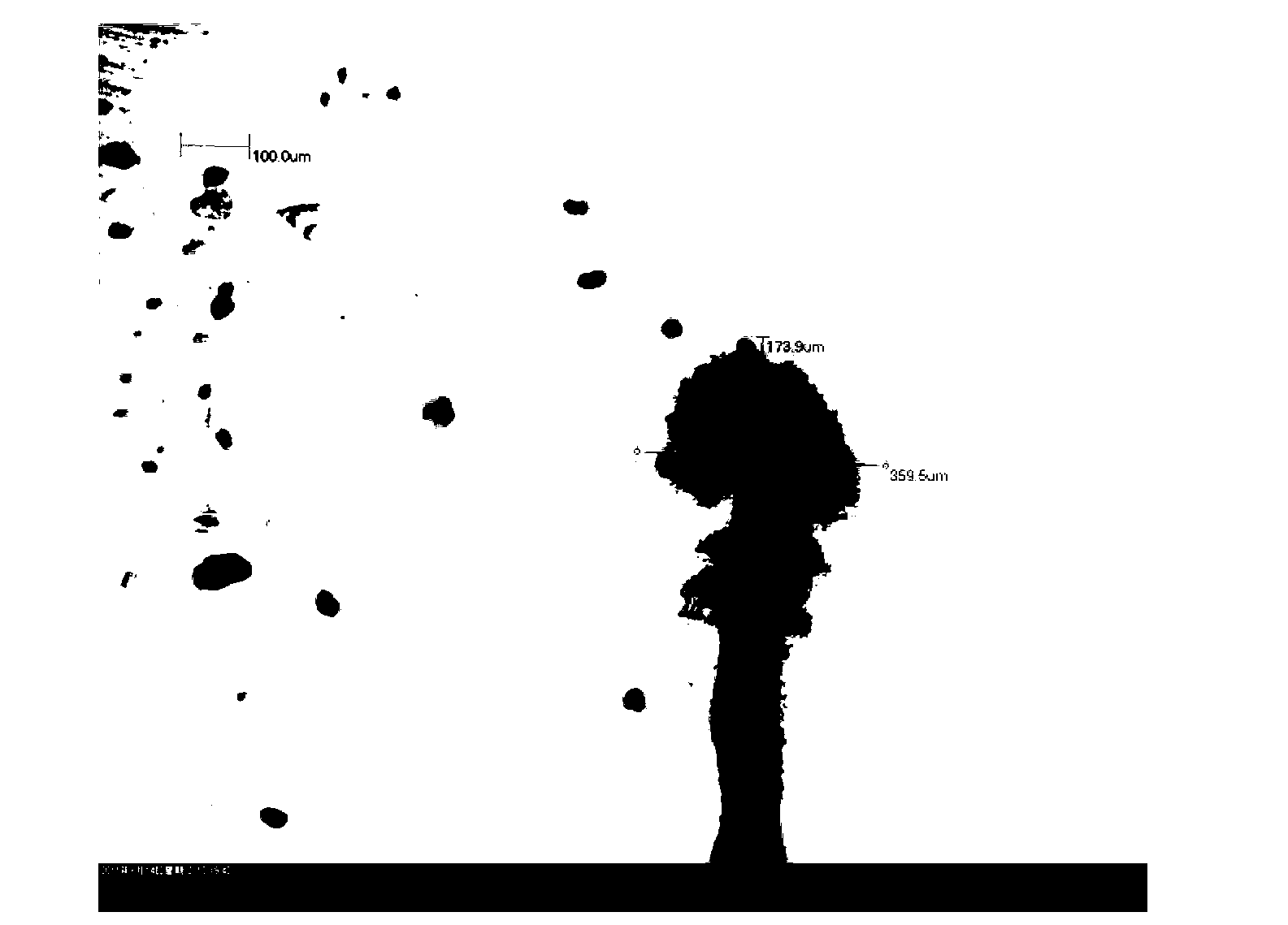 A water tree-resistant polyolefin cable material and a preparation method thereof