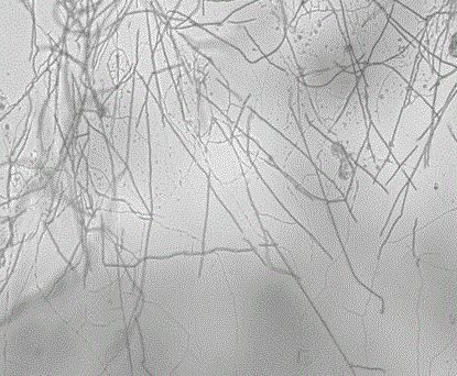 A radiation-resistant Fusarium fungus and its application in biological treatment of adsorbed cesium