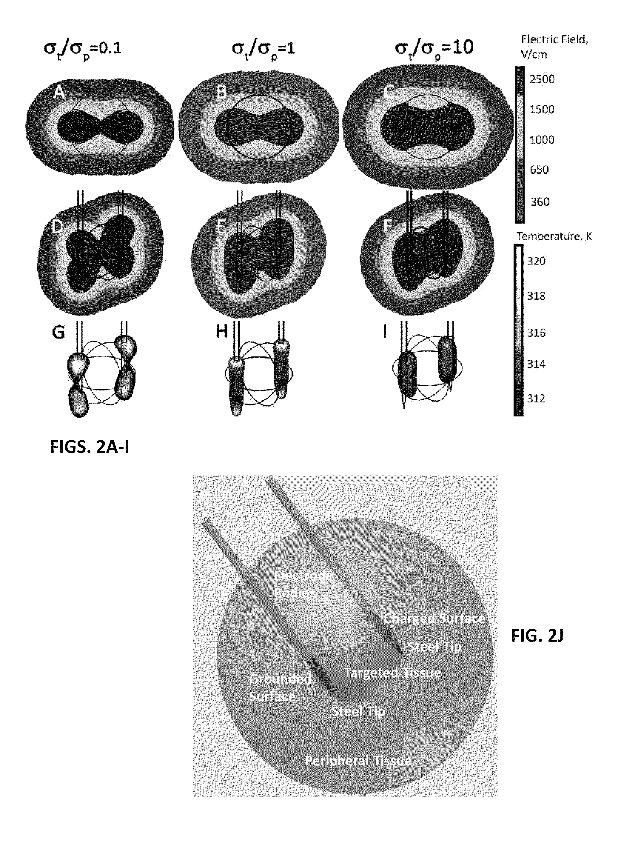 Treatment planning for electroporation-based therapies