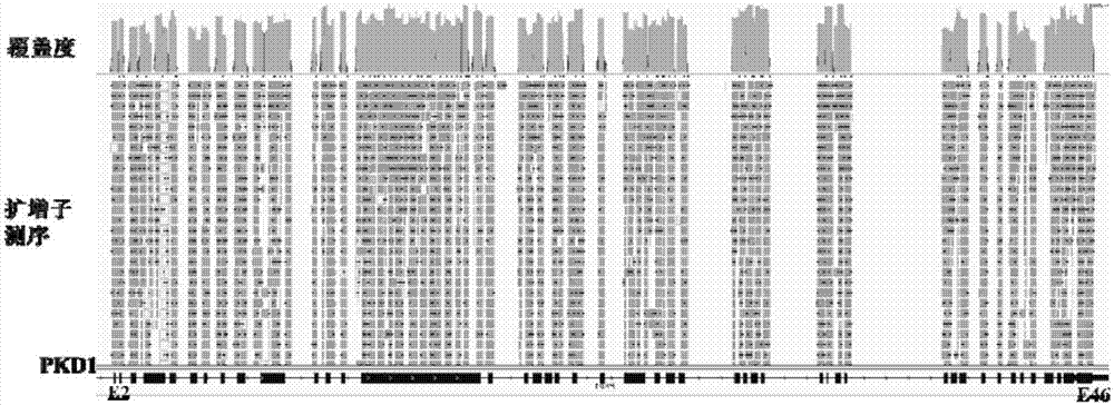 PCR (polymerase chain reaction) primer for amplifying PKD (polystic kidney disease)1 exon ultra-long fragment, kit for detecting PKD1 gene mutation and application