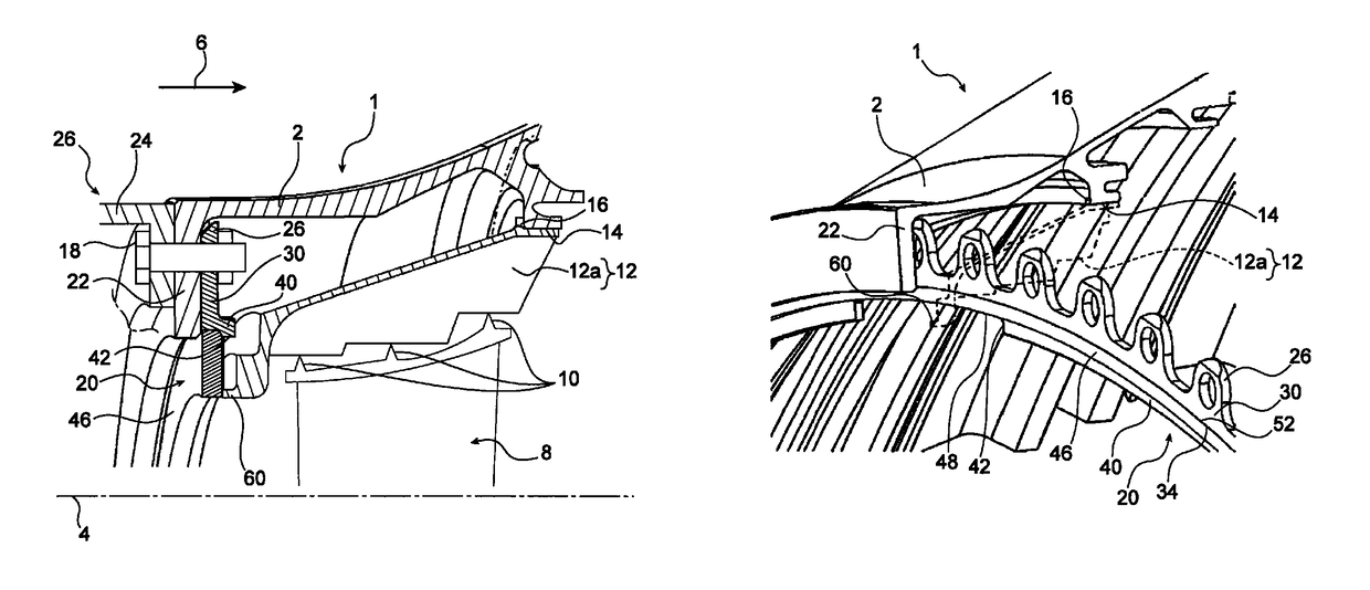 Unlockable device for axially arresting a sealing ring with which an aircraft turbomachine module rotor wheel makes contact