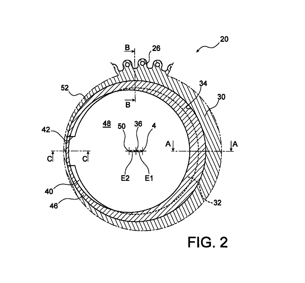 Unlockable device for axially arresting a sealing ring with which an aircraft turbomachine module rotor wheel makes contact