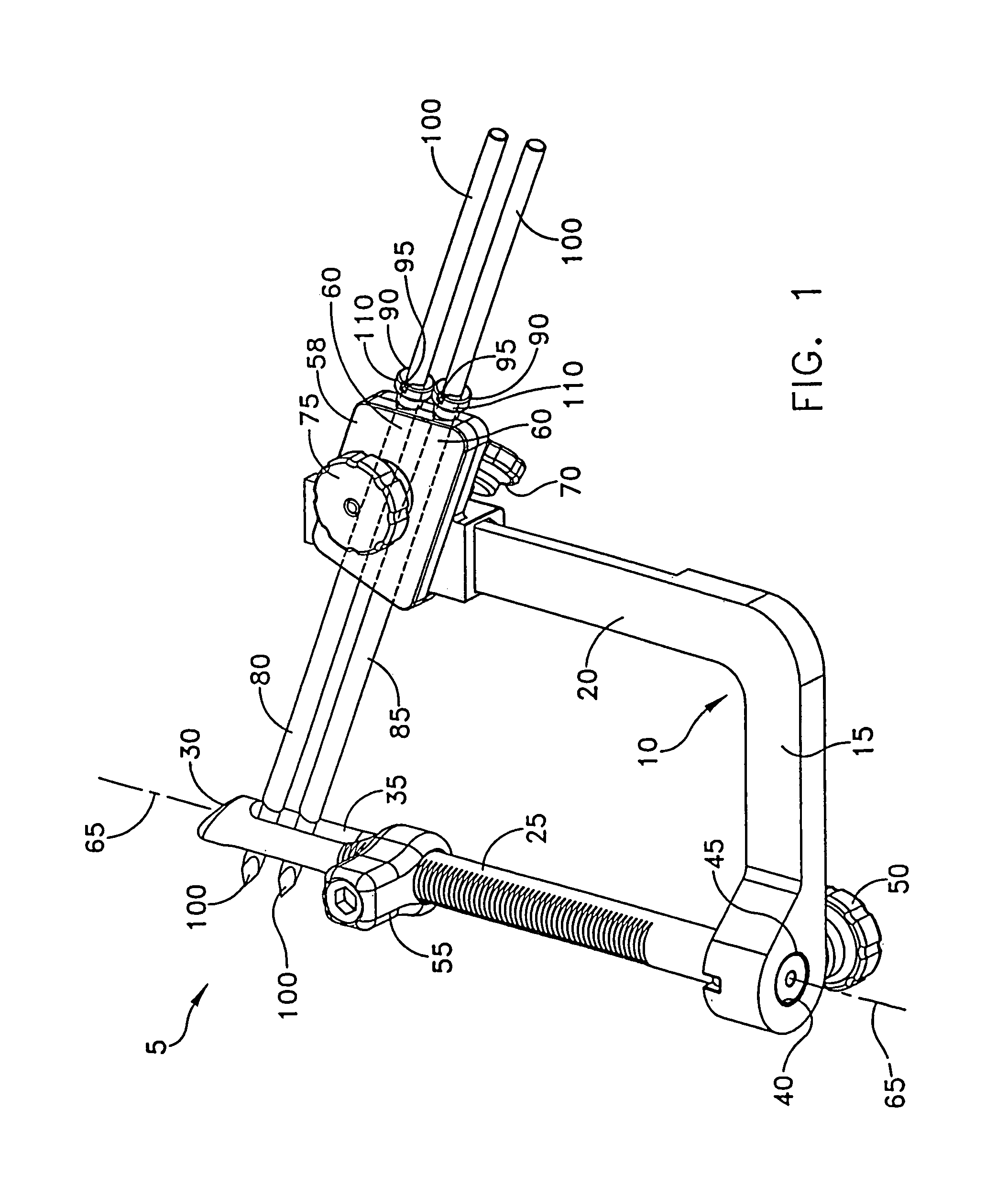 Method and apparatus for fixing a graft in a bone tunnel