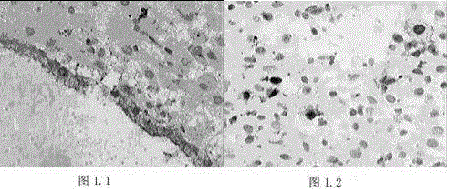 Screening method for differentially expressed proteins of heterotopic-pregnancy and non-pregnancy decidua tissue