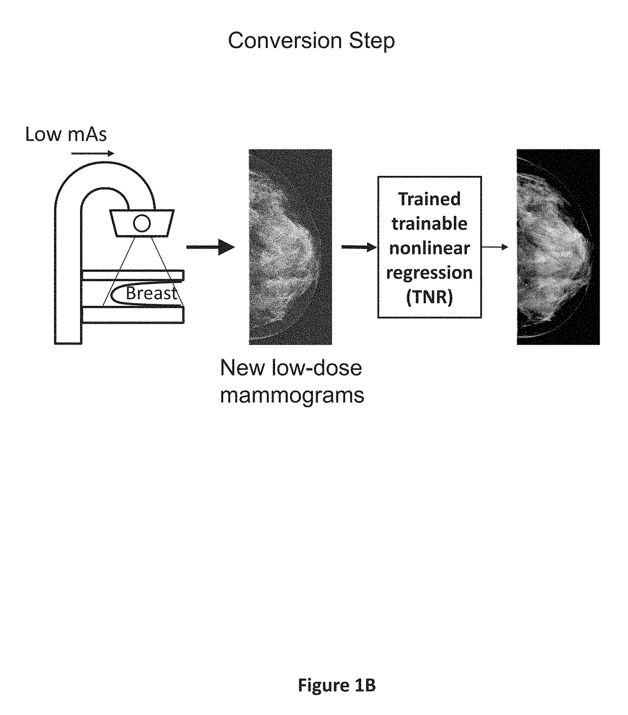 Converting low-dose to higher dose mammographic images through machine-learning processes