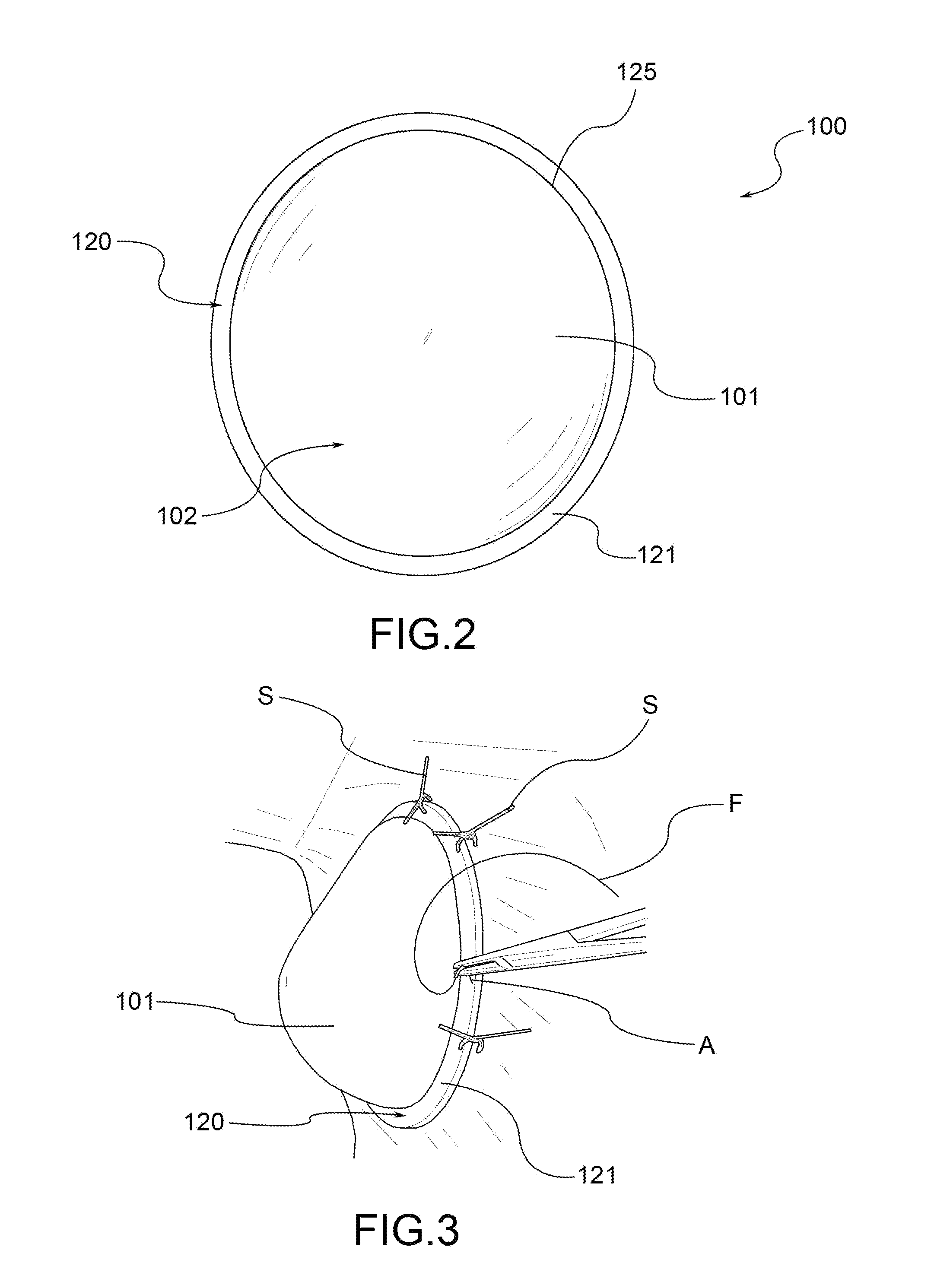 Self-supporting prosthesis for plastic and reconstructive surgery