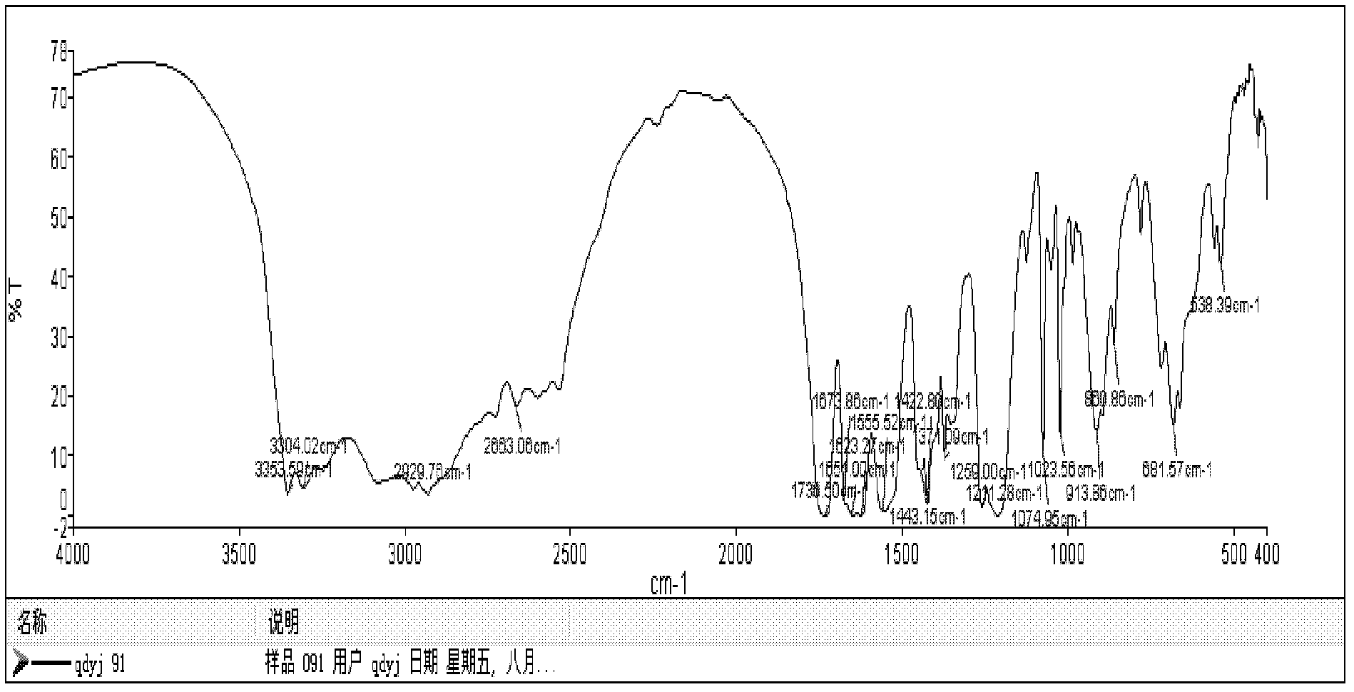 Method for preparing and purifying tiopronin disulphide