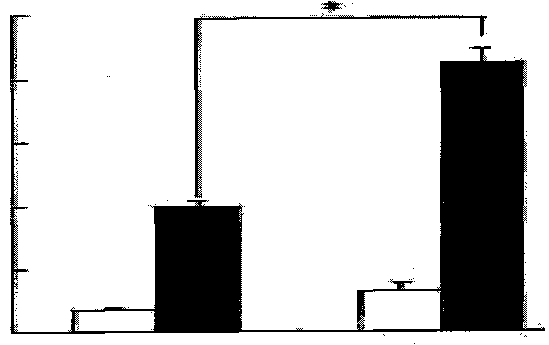 Application of nitidine chloride to preparation of medicament for resisting autoimmunity disease and graft versus host disease