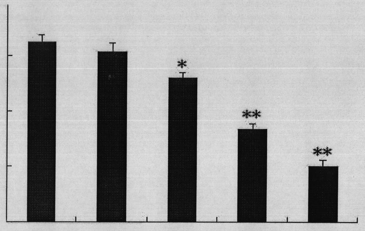 Application of nitidine chloride to preparation of medicament for resisting autoimmunity disease and graft versus host disease