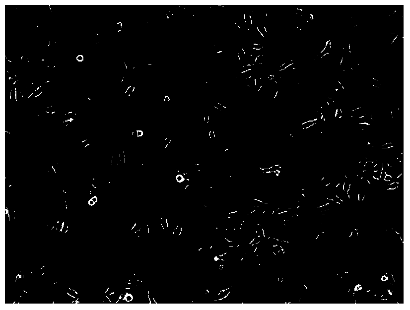 A culture medium and culture method of liver stem cells