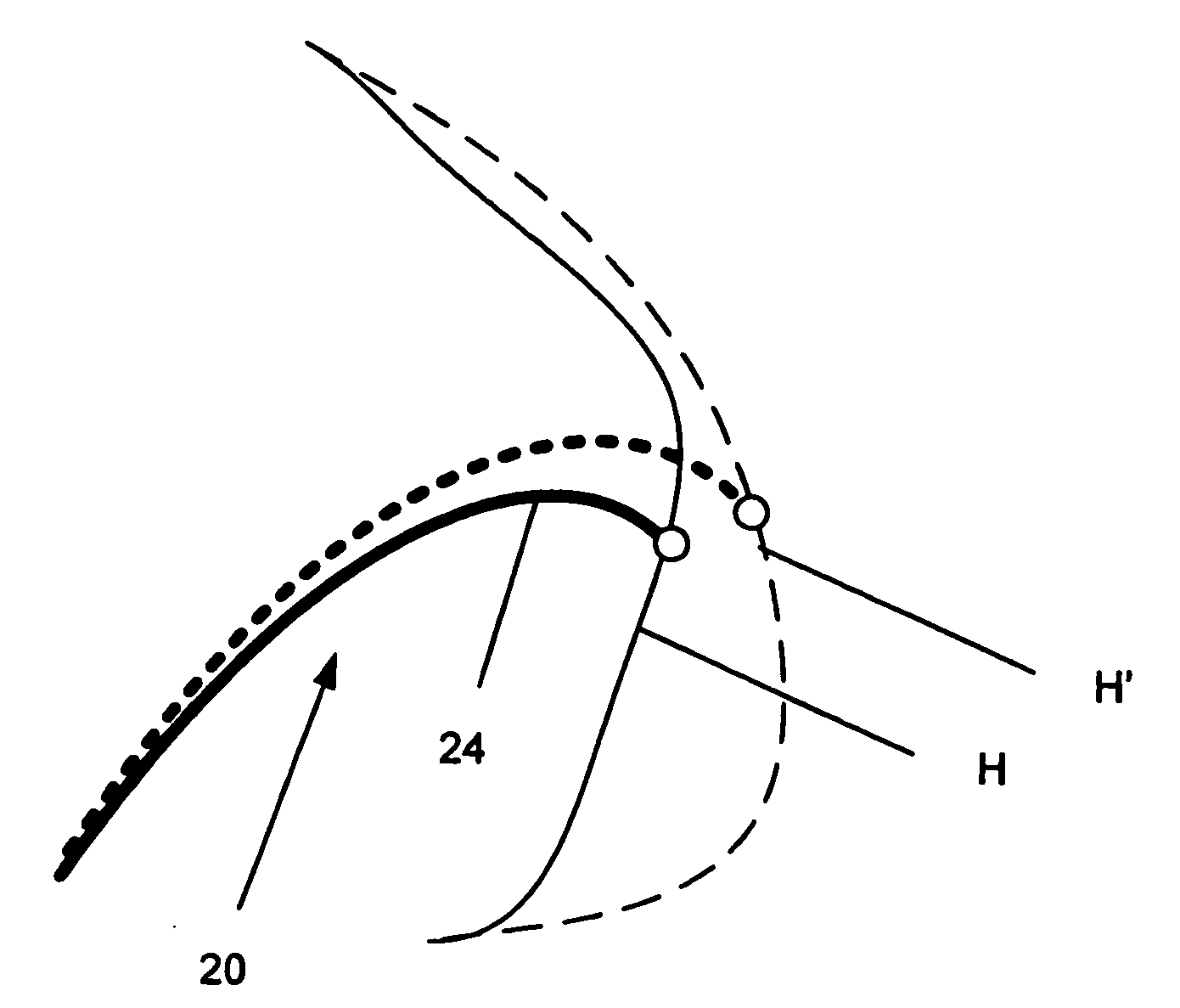 Electrophysiology catheter and system for gentle and firm wall contact