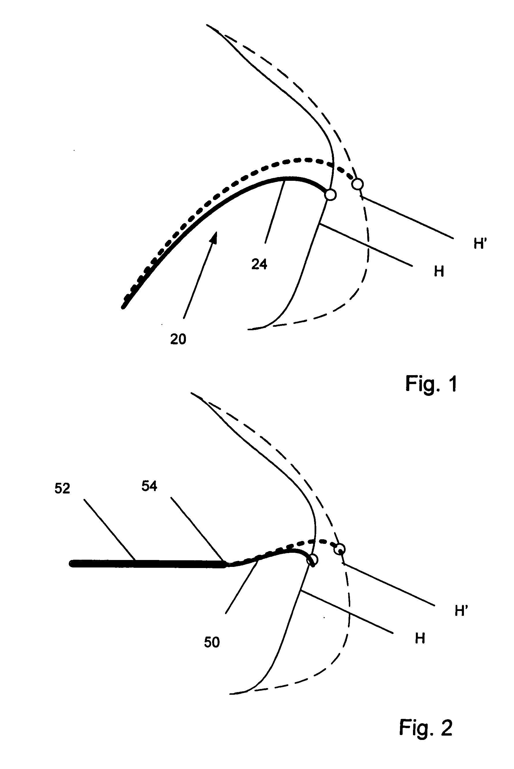 Electrophysiology catheter and system for gentle and firm wall contact