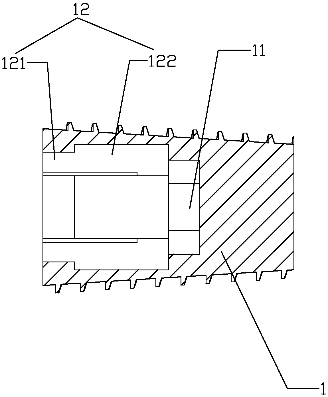 Four-section dental implant