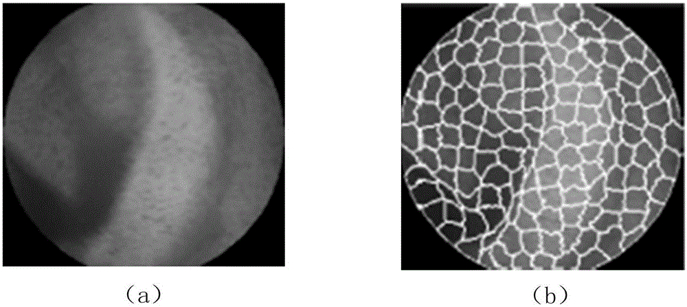 Time series based method for positioning bleeding segments in WCE (wireless capsule endoscope) video