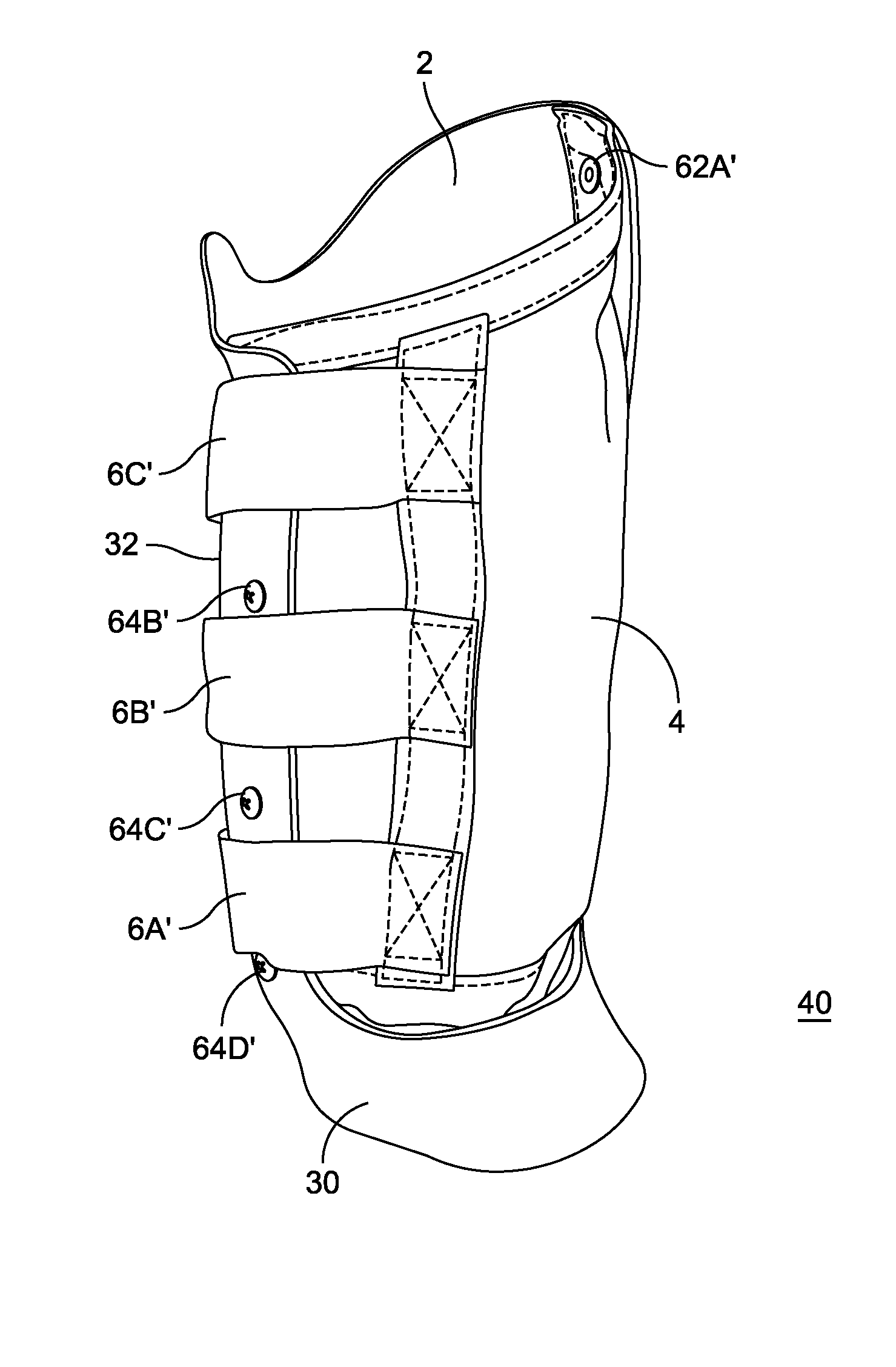 Adjustable prosthetic limb socket