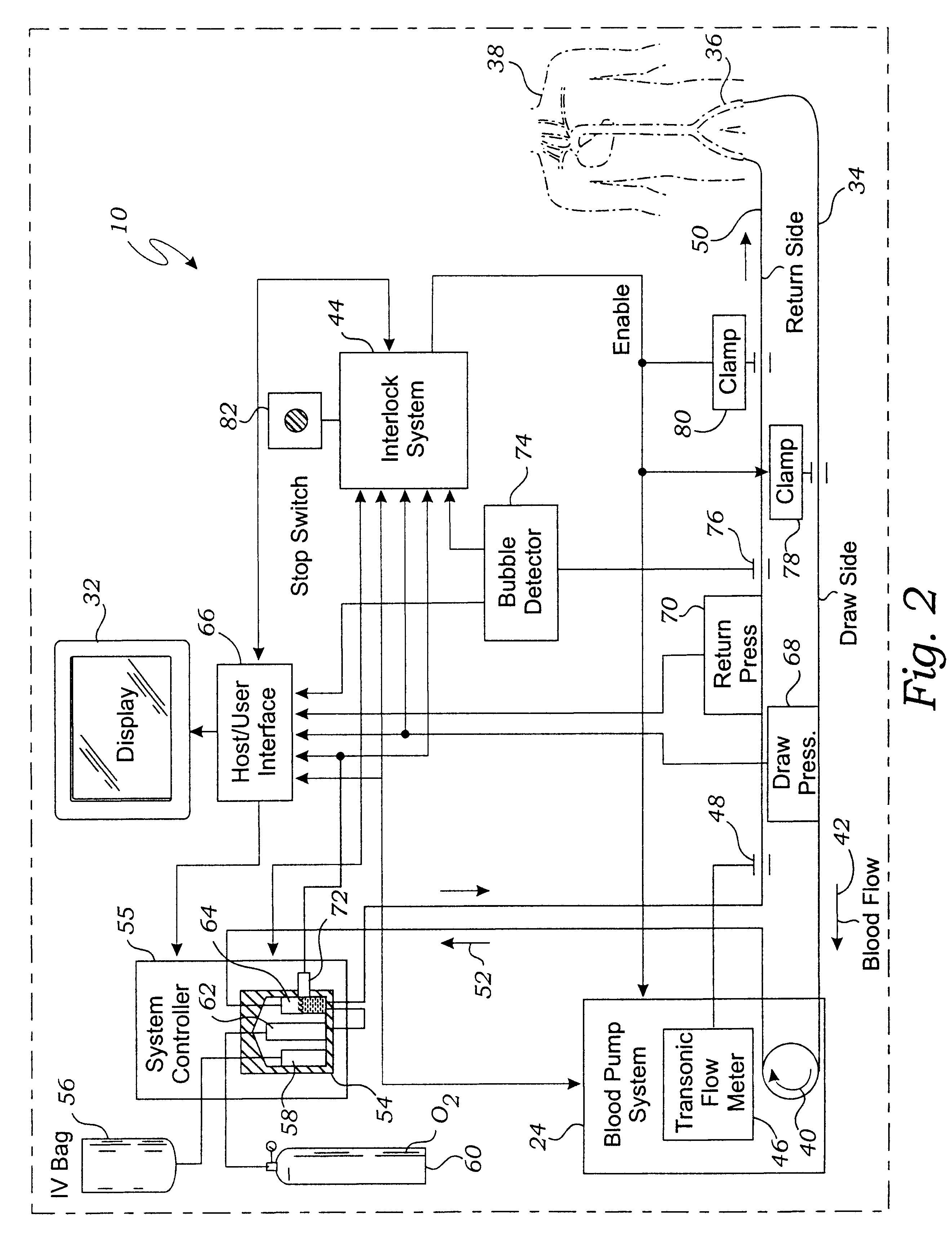 System for enriching a bodily fluid with a gas