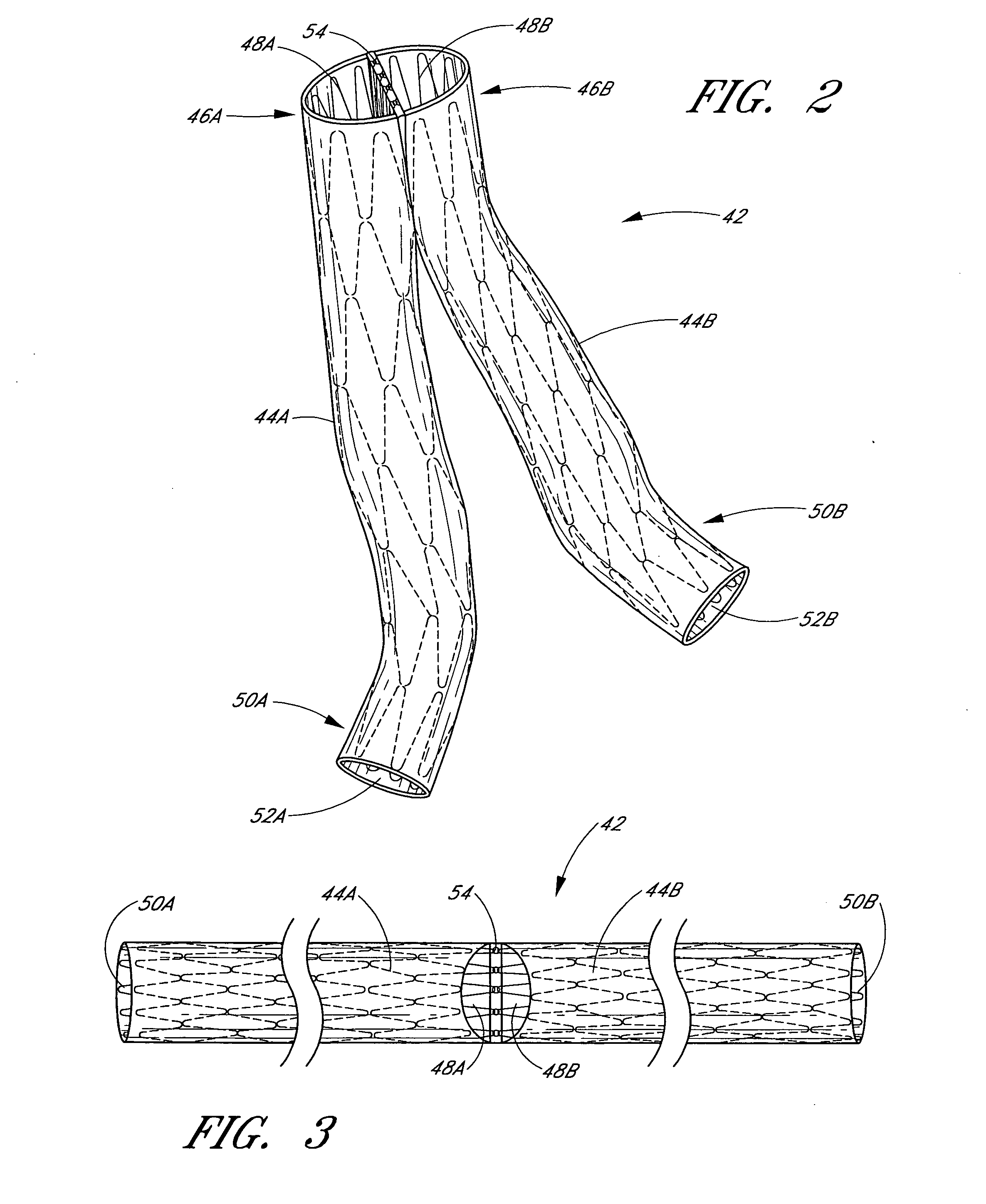 Vascular graft and deployment system