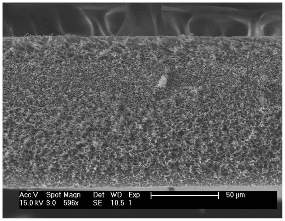 Microporous filter membrane and preparation method thereof