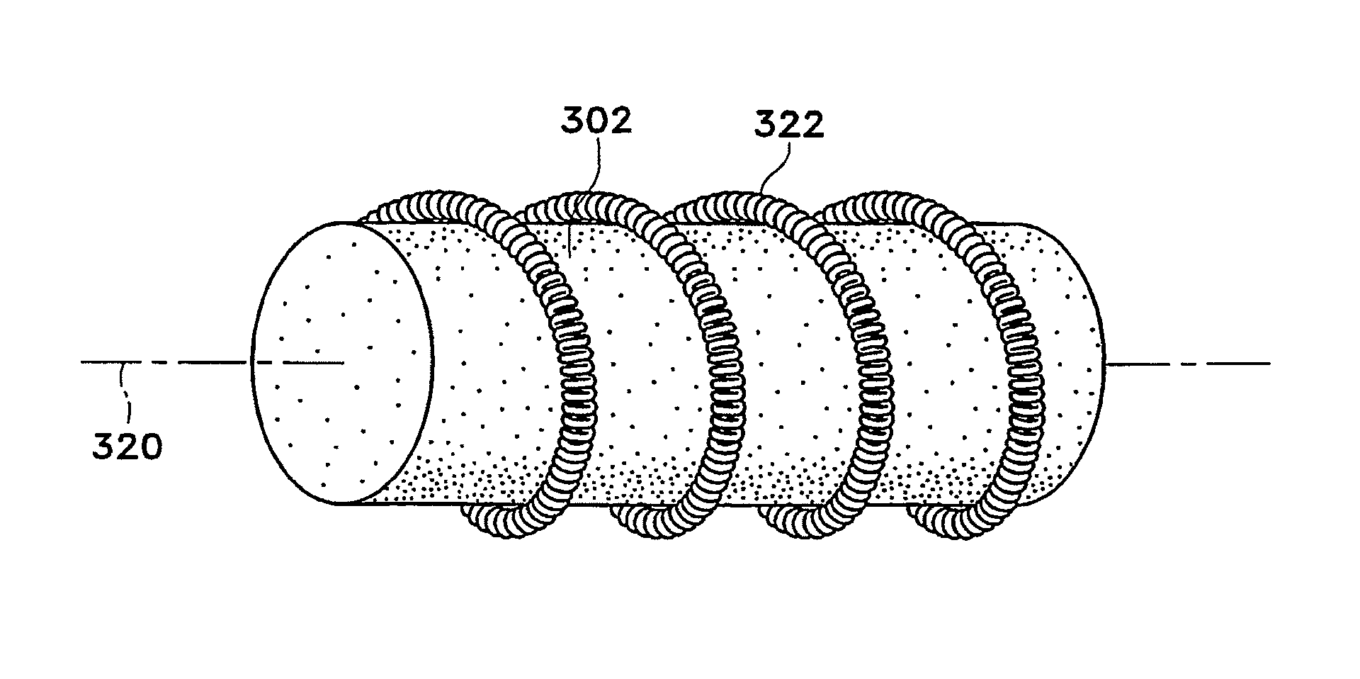 Device and method for safe location and marking of a biopsy cavity