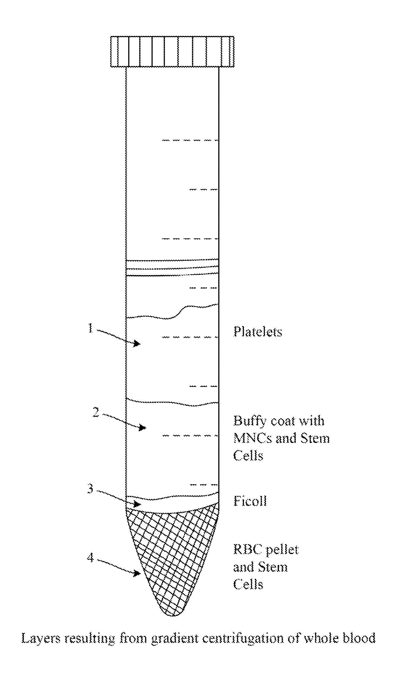 Personalized production of biologics and method for reprogramming somatic cells