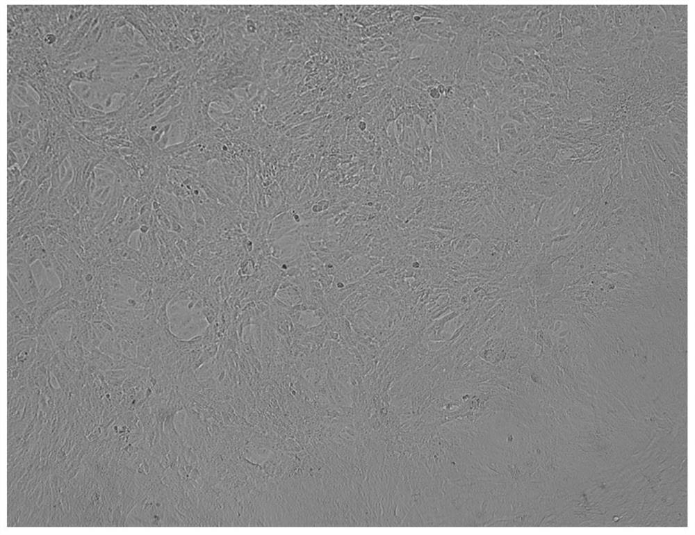 Novel coronavirus and culture method thereof, and novel coronavirus inactivated vaccine