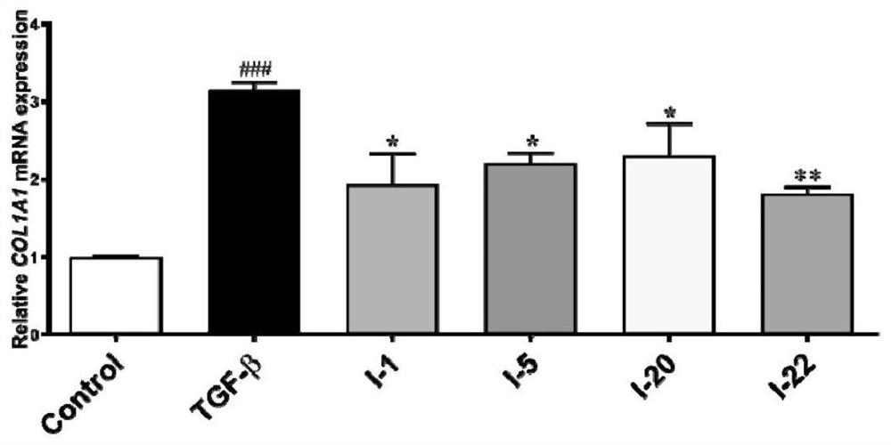 ASK1 inhibitor, derivative, preparation method, pharmaceutical composition and application thereof