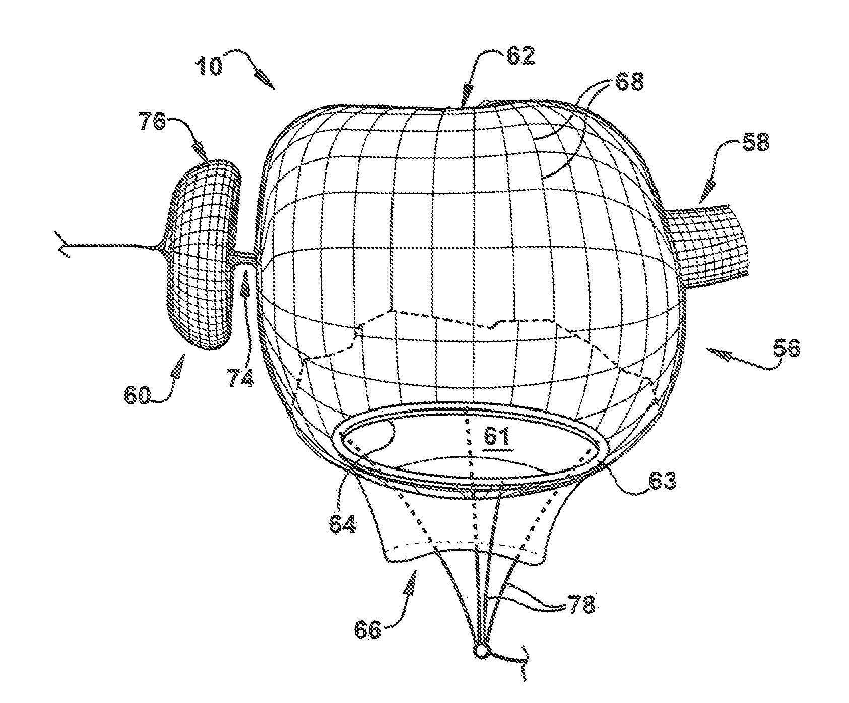 Percutaneous atrioventricular valve and method of use