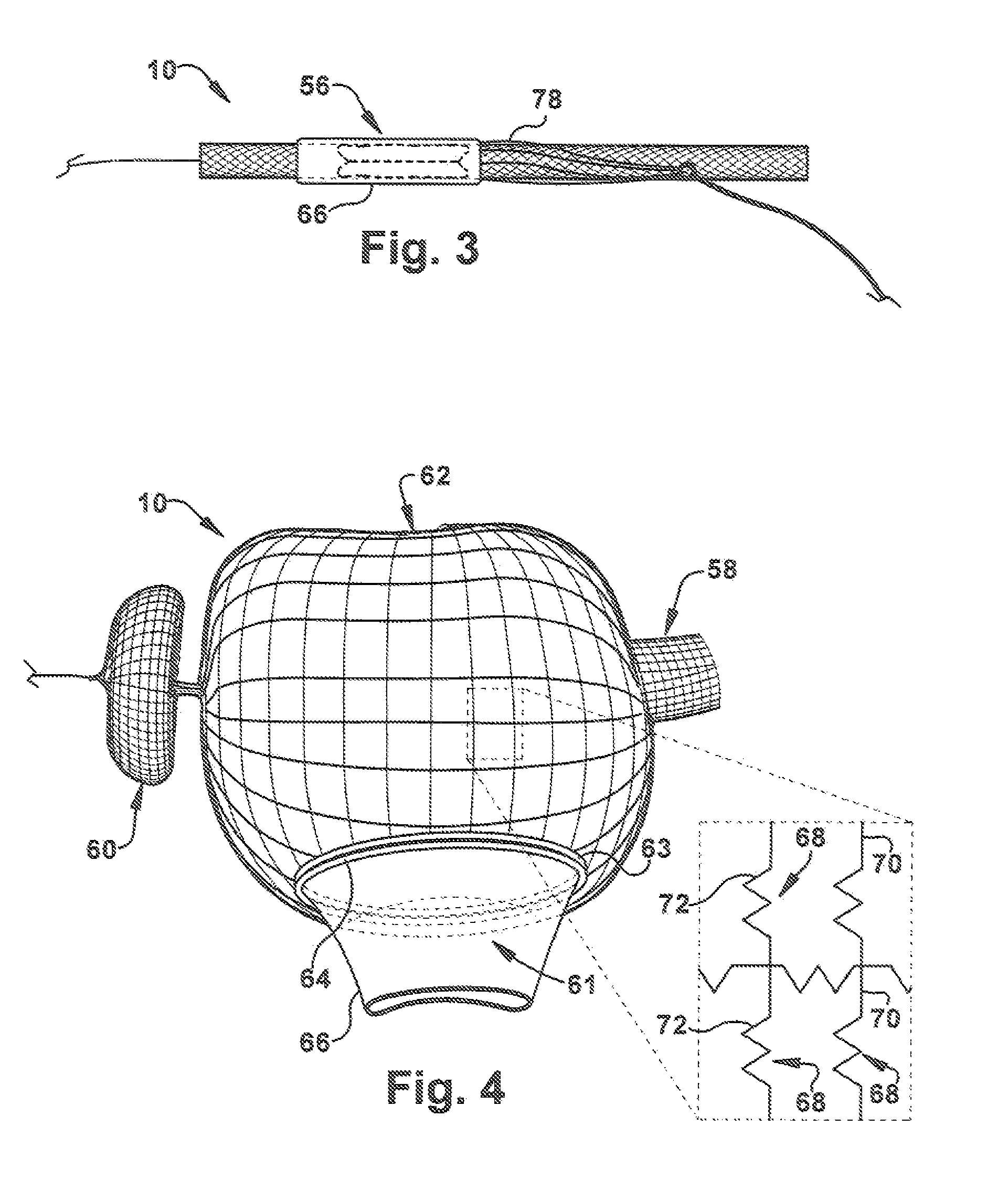 Percutaneous atrioventricular valve and method of use