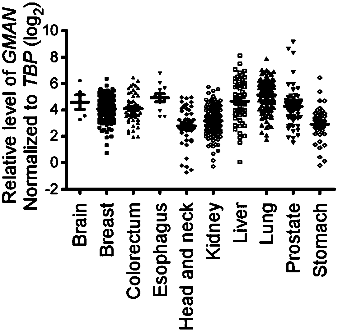 Tumor-associated sequence and long non-coding RNA and application thereof