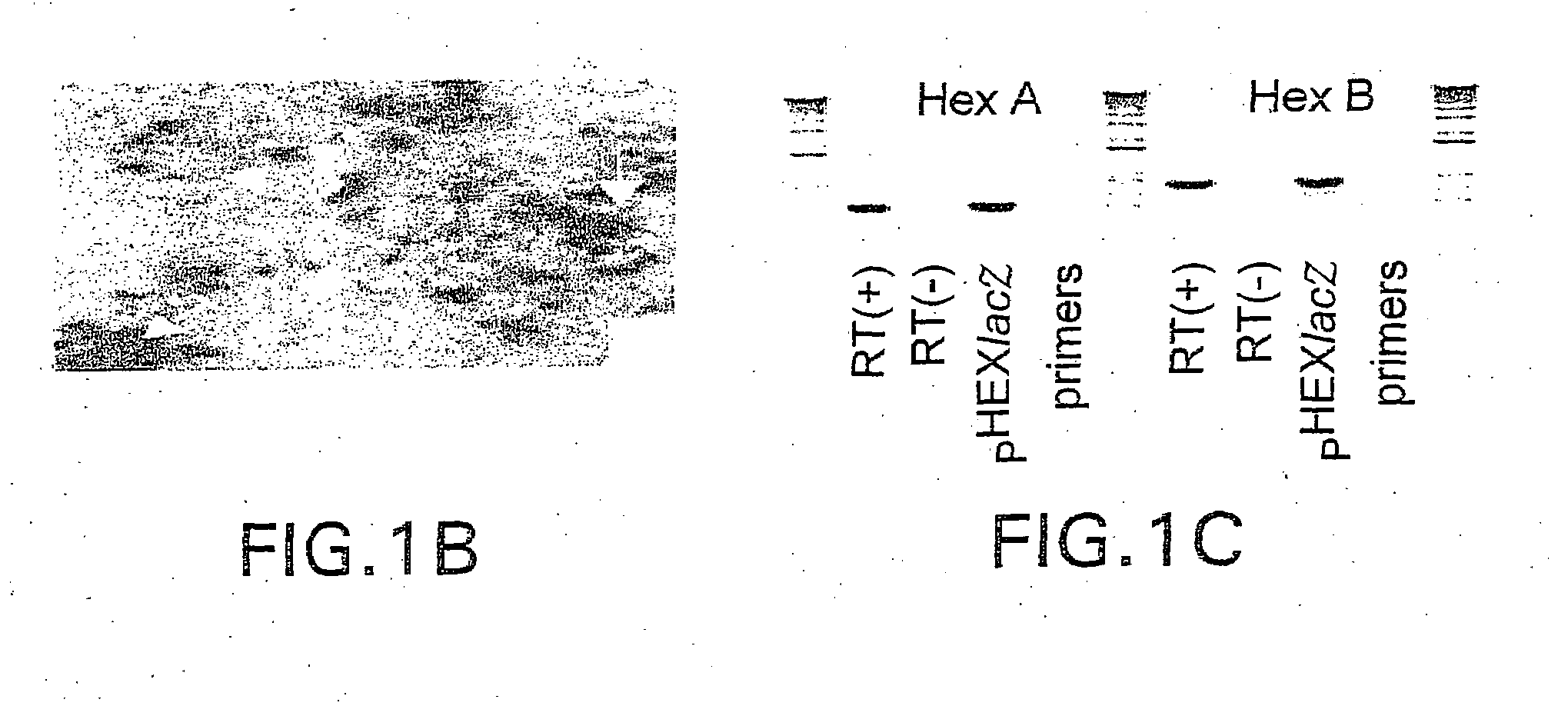 Vectors having both isoforms of beta-hexosaminidase and uses of the same