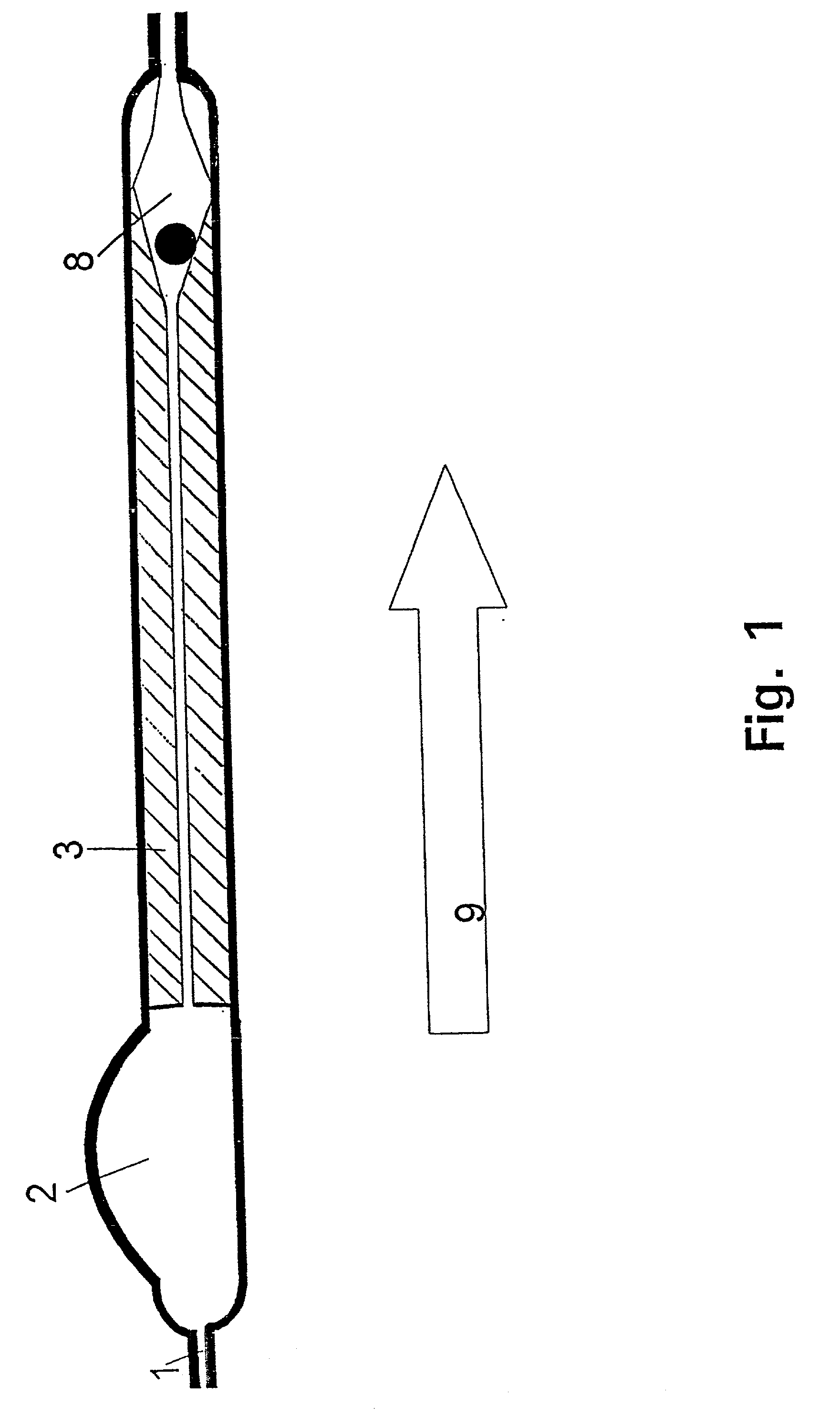 Device for the treatment of hydrocephalus