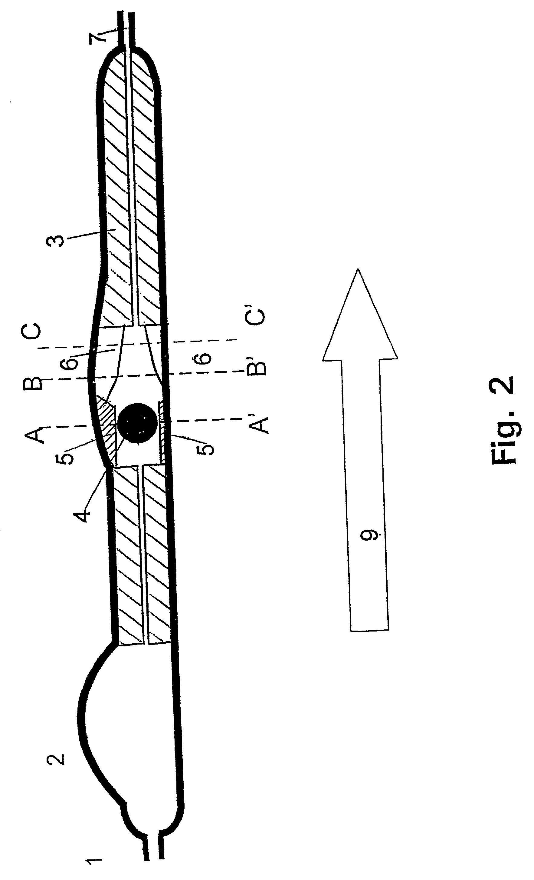 Device for the treatment of hydrocephalus