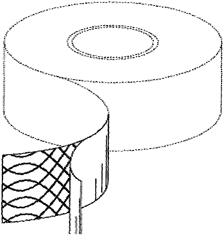 Elastic restraint device and preparation method thereof