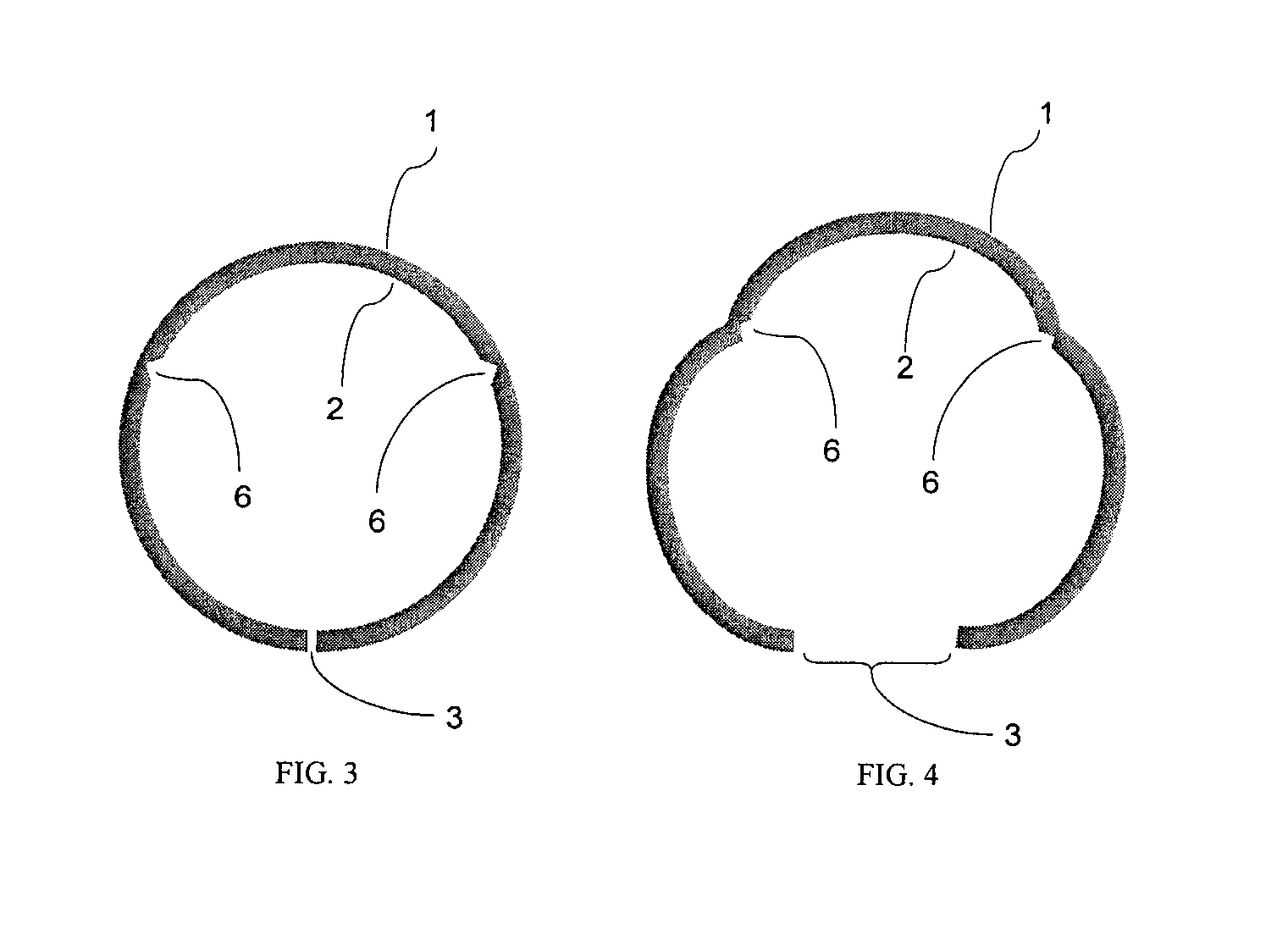 Encasement devices and methods for planting mangroves