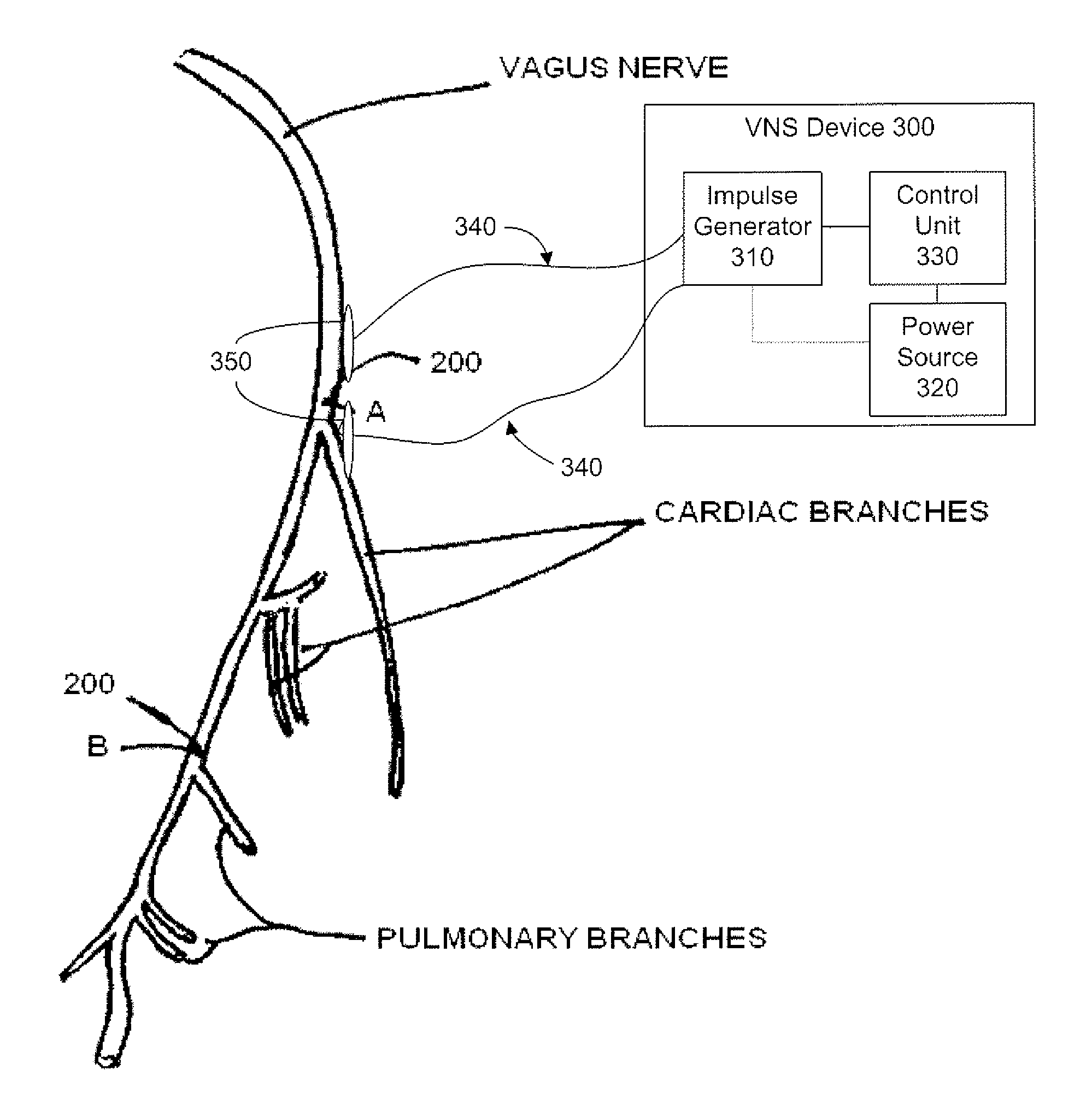 Electrical stimulation treatment of hypotension