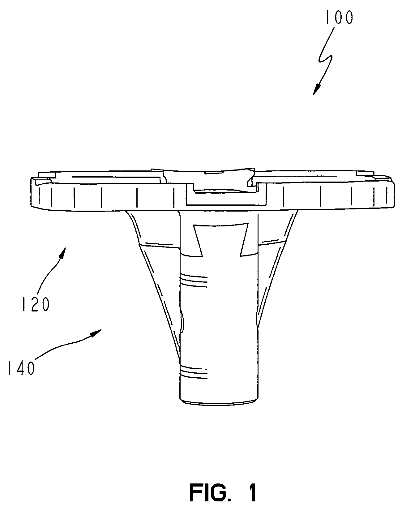 Modular tibial implant with a mortise coupling