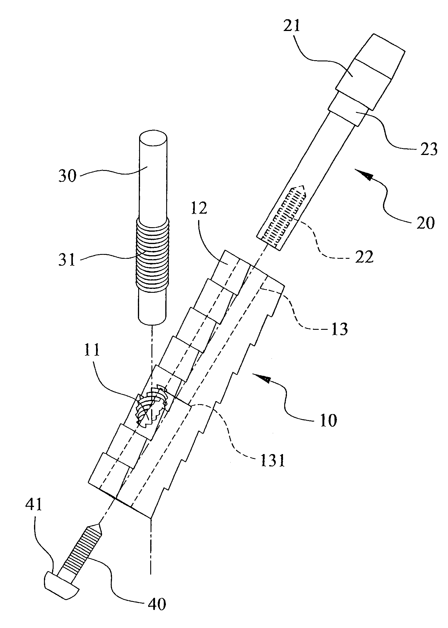 Thighbone shaft