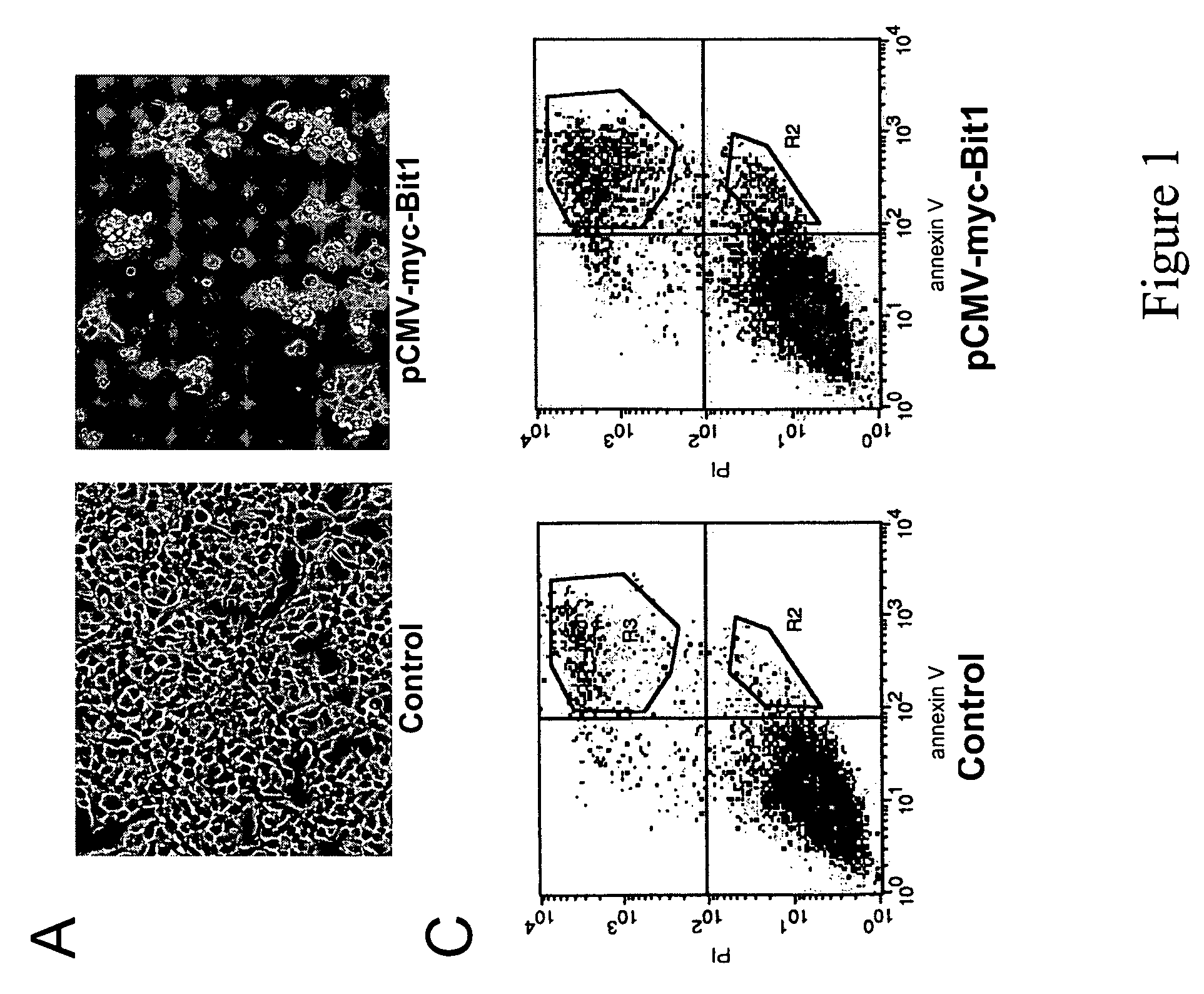 Methods of modulating cell death based on the Bit1/AES regulatory pathway